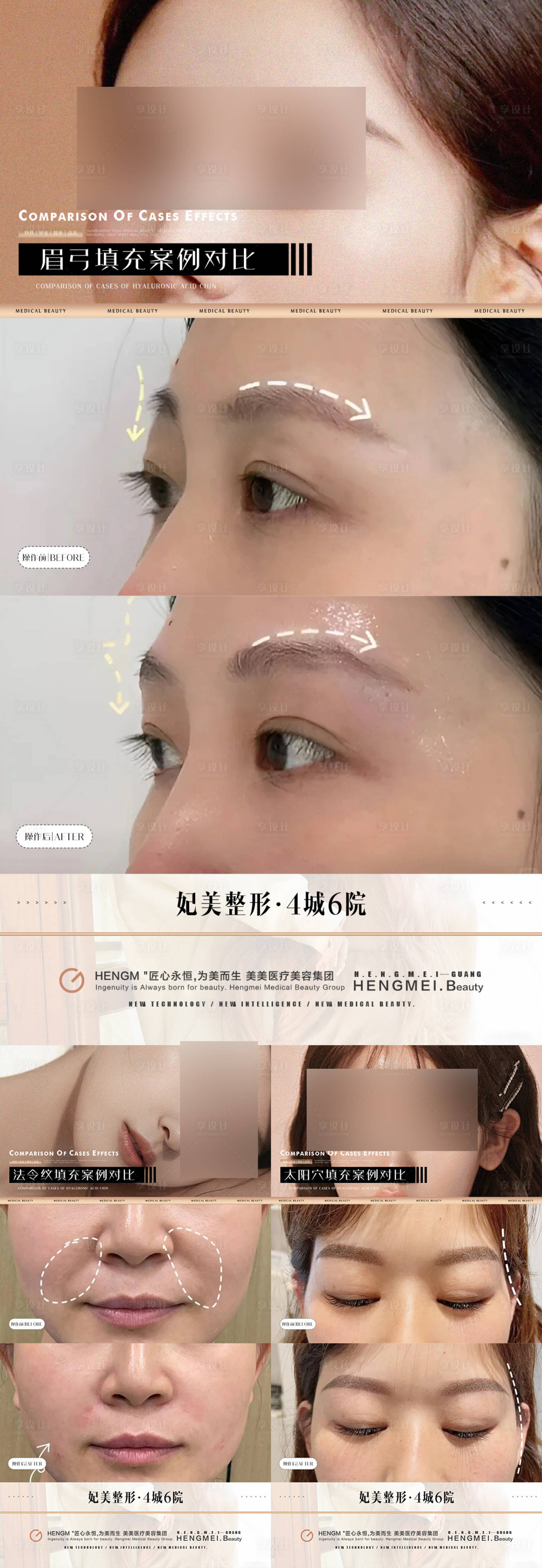 源文件下载【医美美容案例对比】编号：13820022725335760