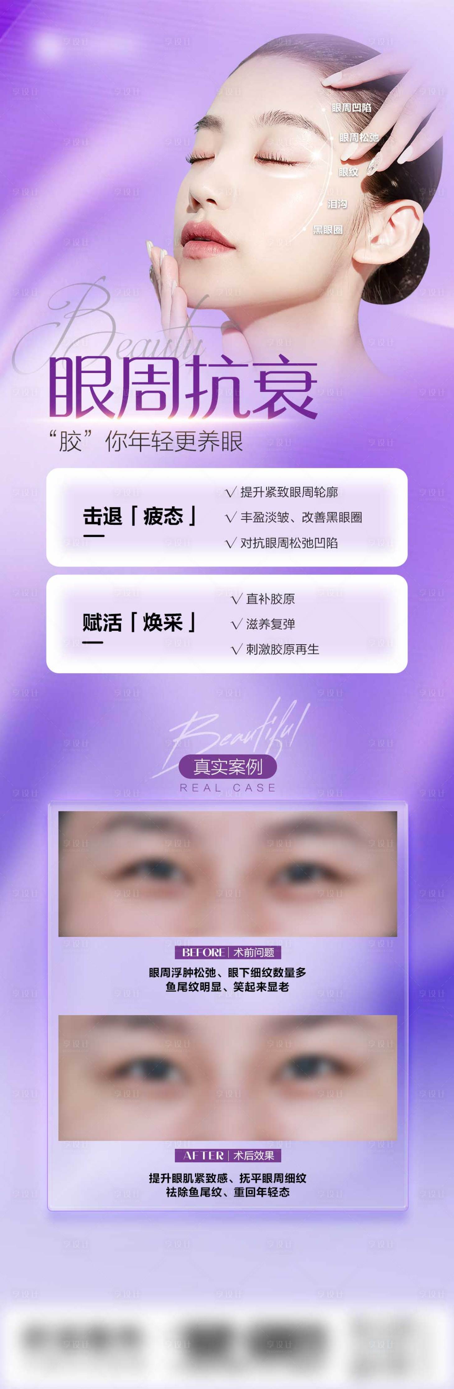 源文件下載【享設計】搜索編號：91890022449646064【眼周抗衰活動海報】