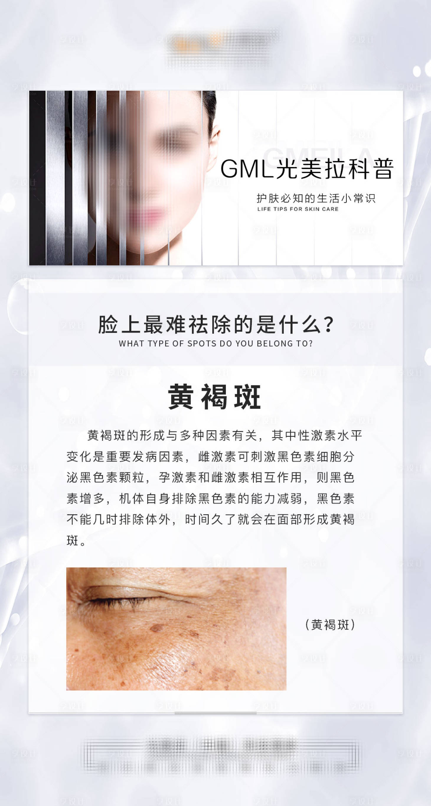 源文件下載【享設(shè)計(jì)】搜索編號(hào)：83470022845669033【美白祛斑小知識(shí)海報(bào)】