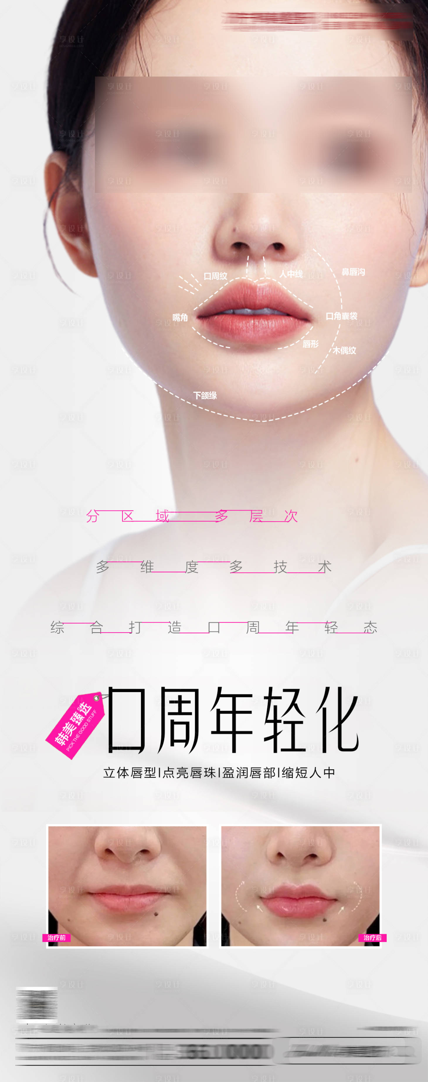 源文件下載【享設計】搜索編號：29720022699271049【醫(yī)美口周年輕化宣傳海報】