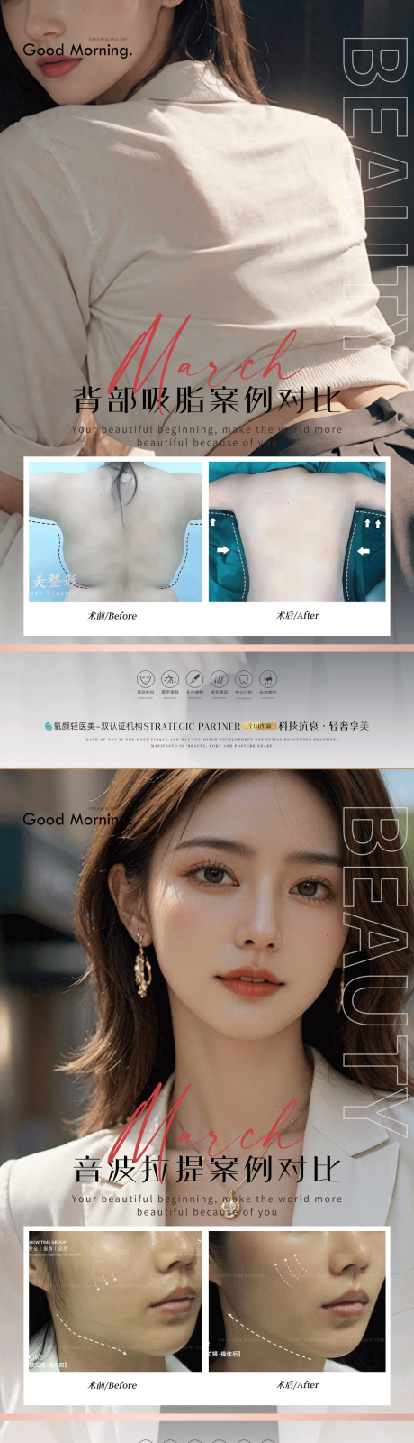 医美美容简约案例海报