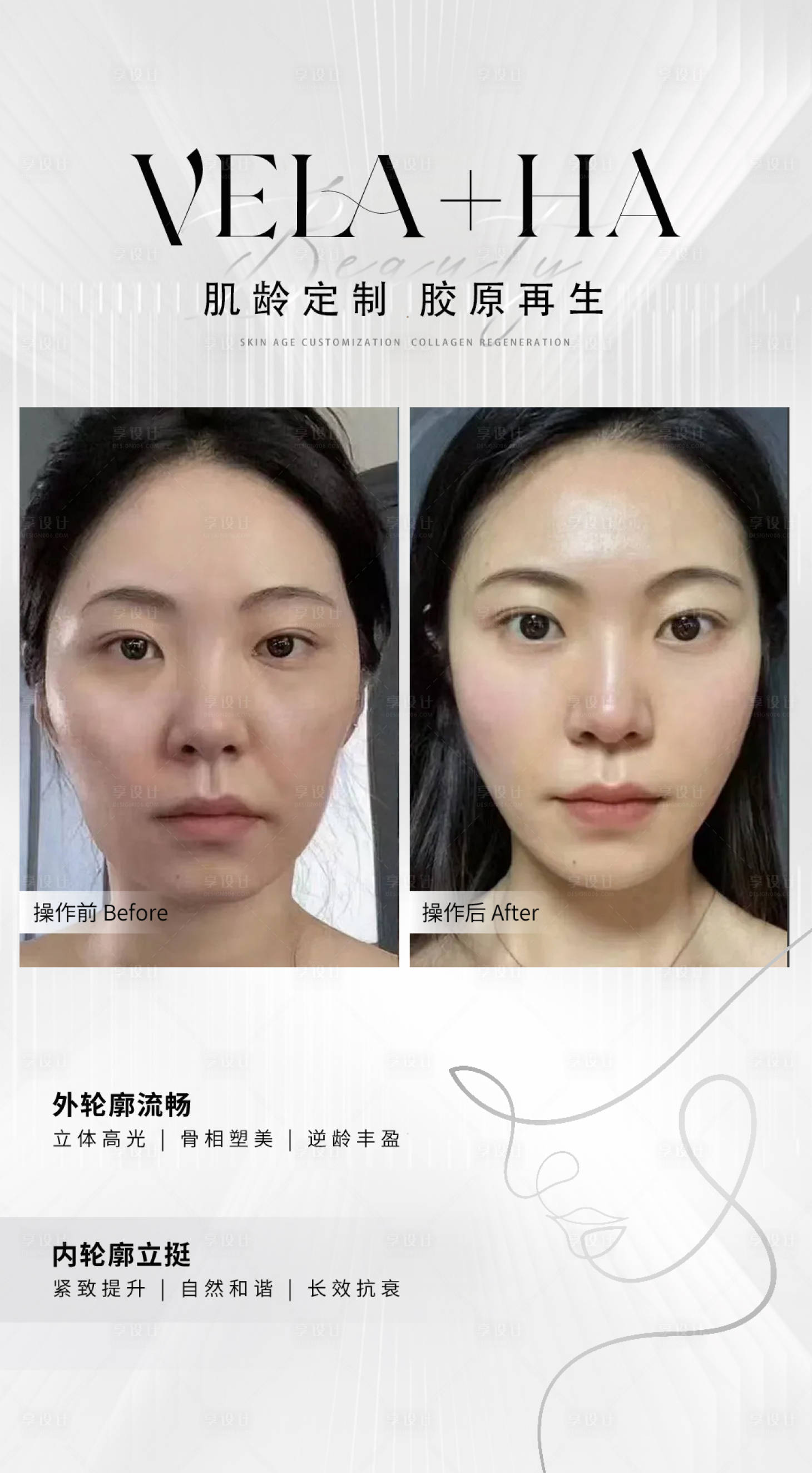 源文件下載【享設計】搜索編號：49650022206275253【醫美抗衰對比圖】