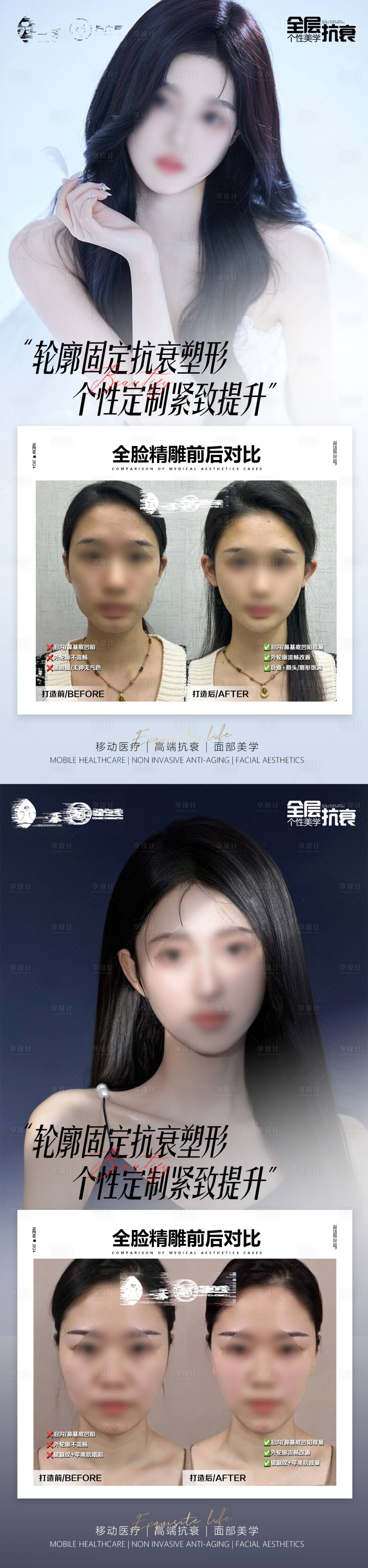 源文件下載【享設計】搜索編號：15880022914845759【醫美全臉精雕案例海報】