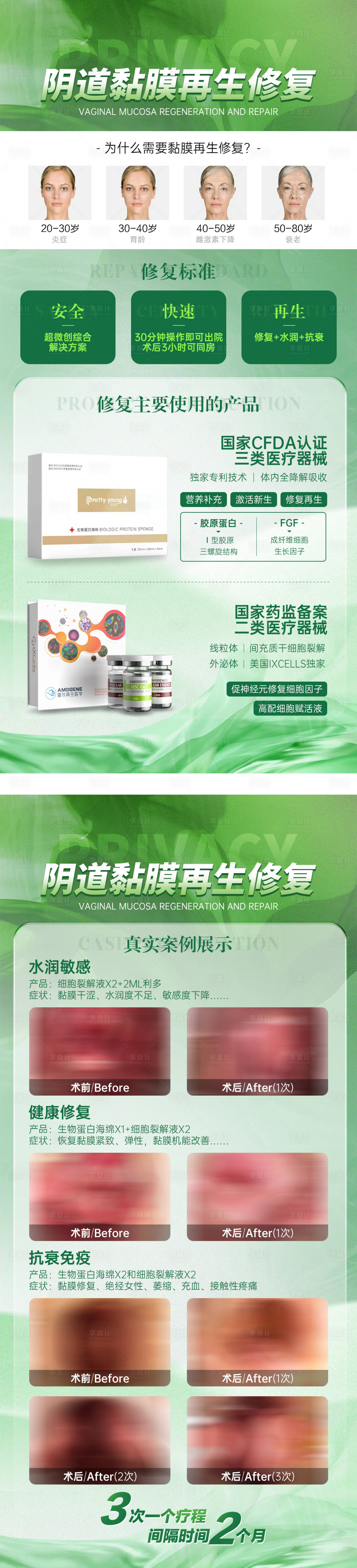 源文件下载【享设计】搜索编号：21610022812572141【私密产品案例海报】