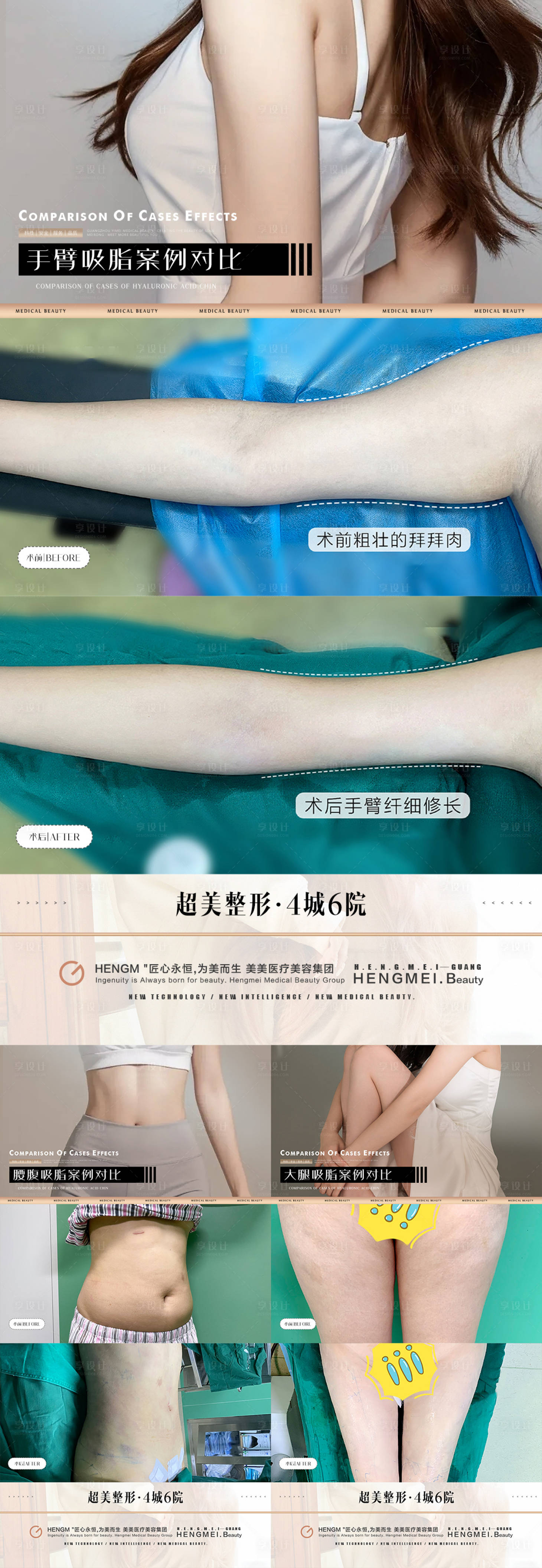 源文件下載【享設(shè)計】搜索編號：82150022466004006【醫(yī)美吸脂案例對比】