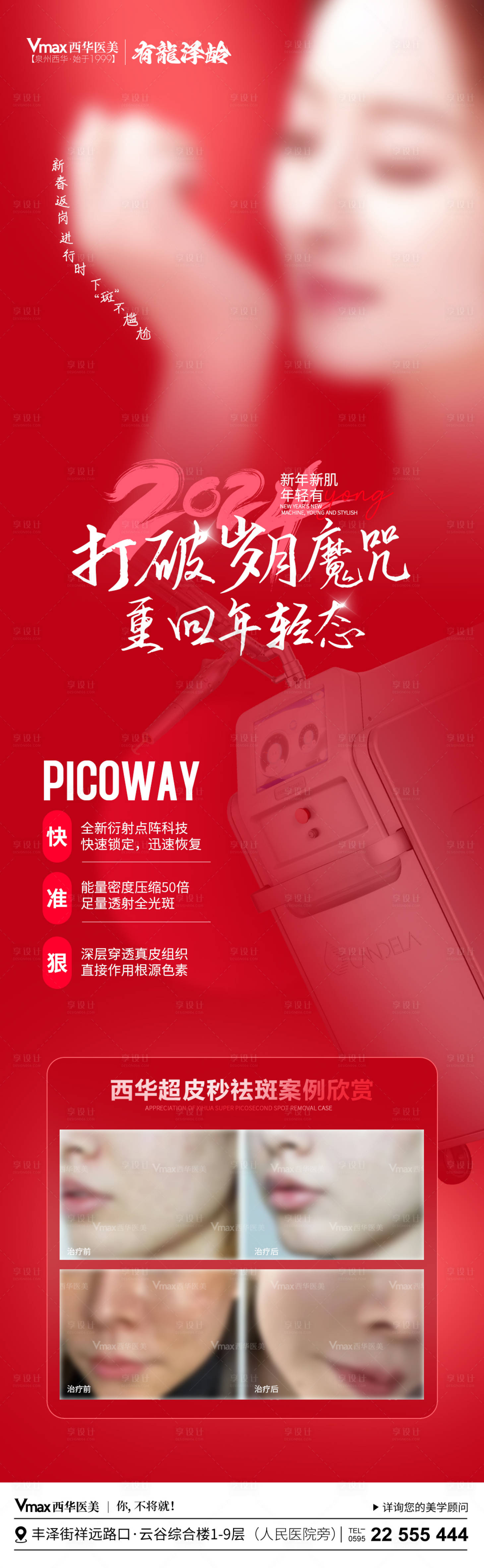 源文件下載【享設計】搜索編號：81250022248876386【醫美超皮秒祛斑宣傳長圖】