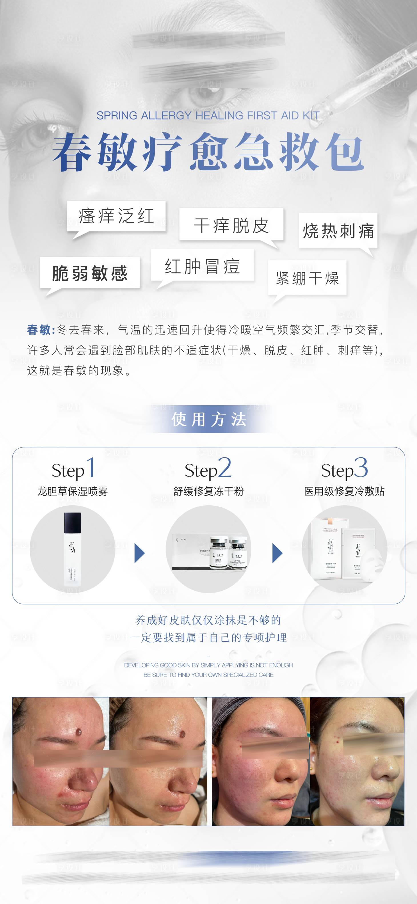 源文件下載【享設計】搜索編號：82080022643695038【醫(yī)美宣傳海報】