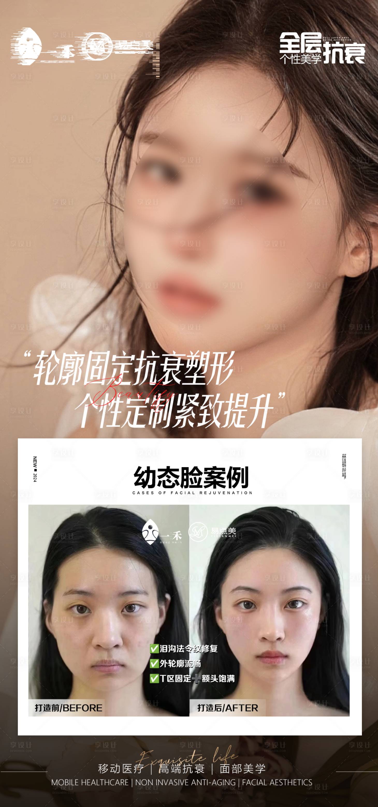源文件下載【享設計】搜索編號：43630022847174839【醫美案例對比海報】