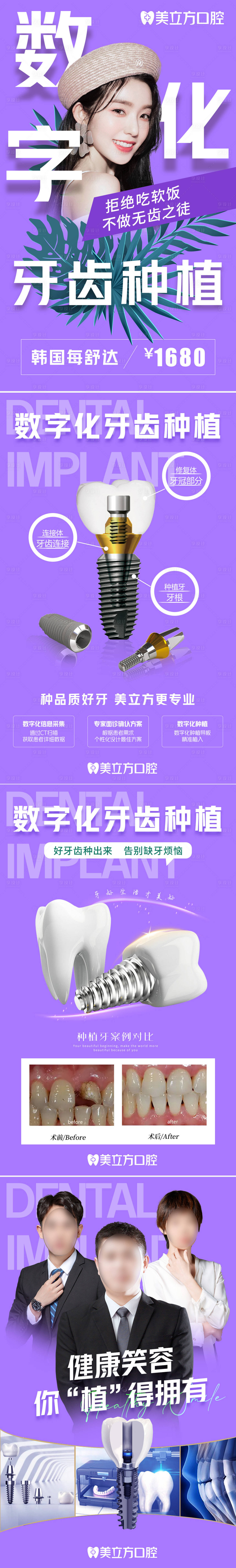 源文件下載【種植牙科普宮格】編號：79860022774492852