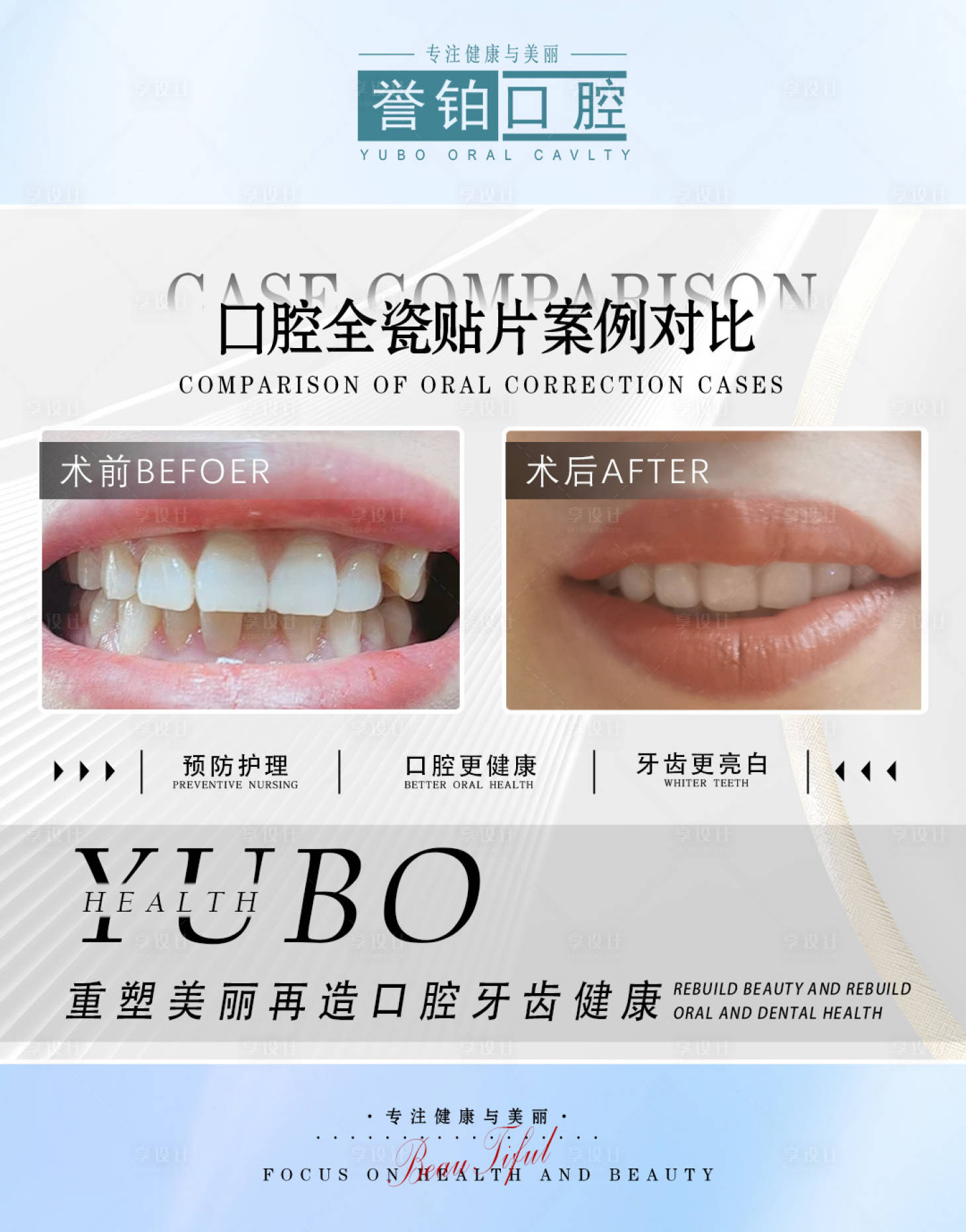 源文件下载【享设计】搜索编号：69540022860549027【口腔案例海报】