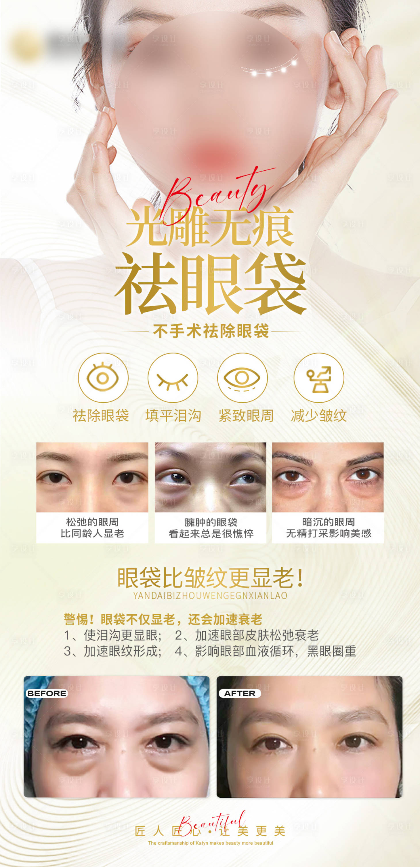 源文件下载【享设计】搜索编号：55280022366777775【祛眼袋】