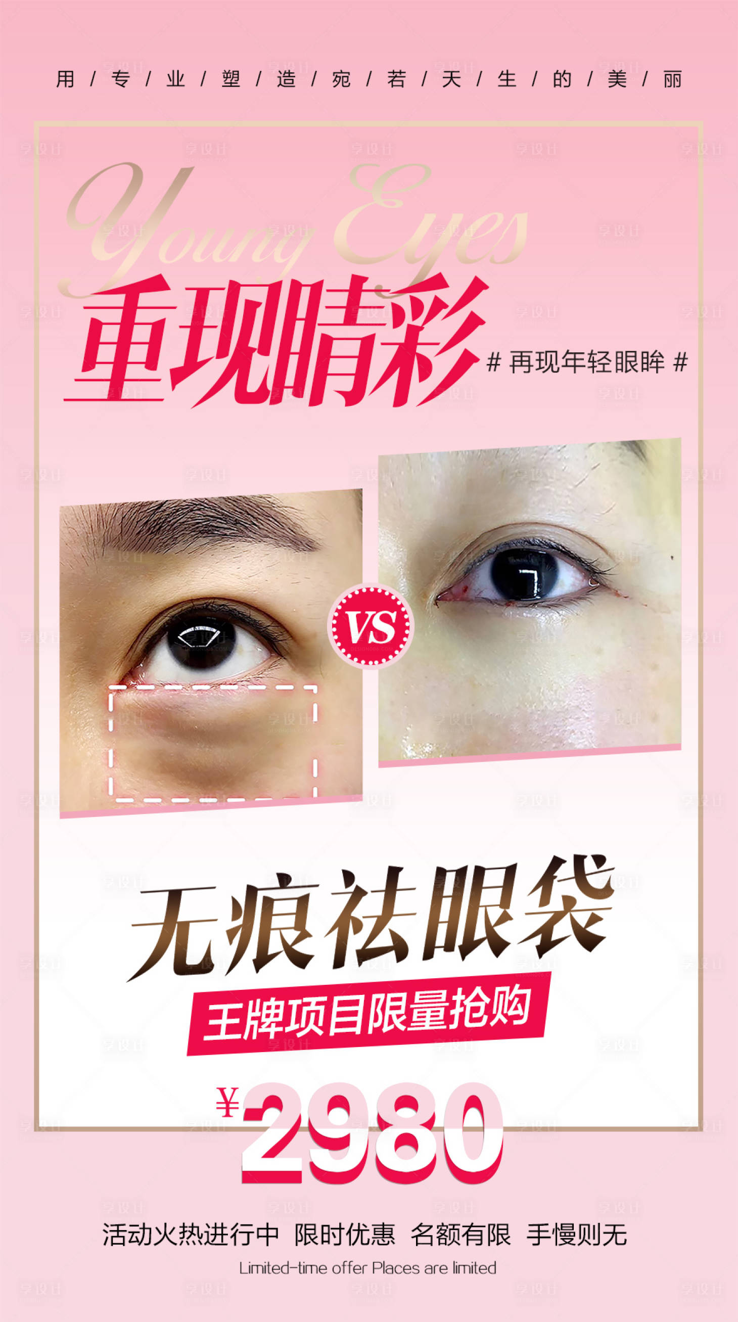 源文件下载【医美春季祛眼袋活动海报】编号：68730022614142348