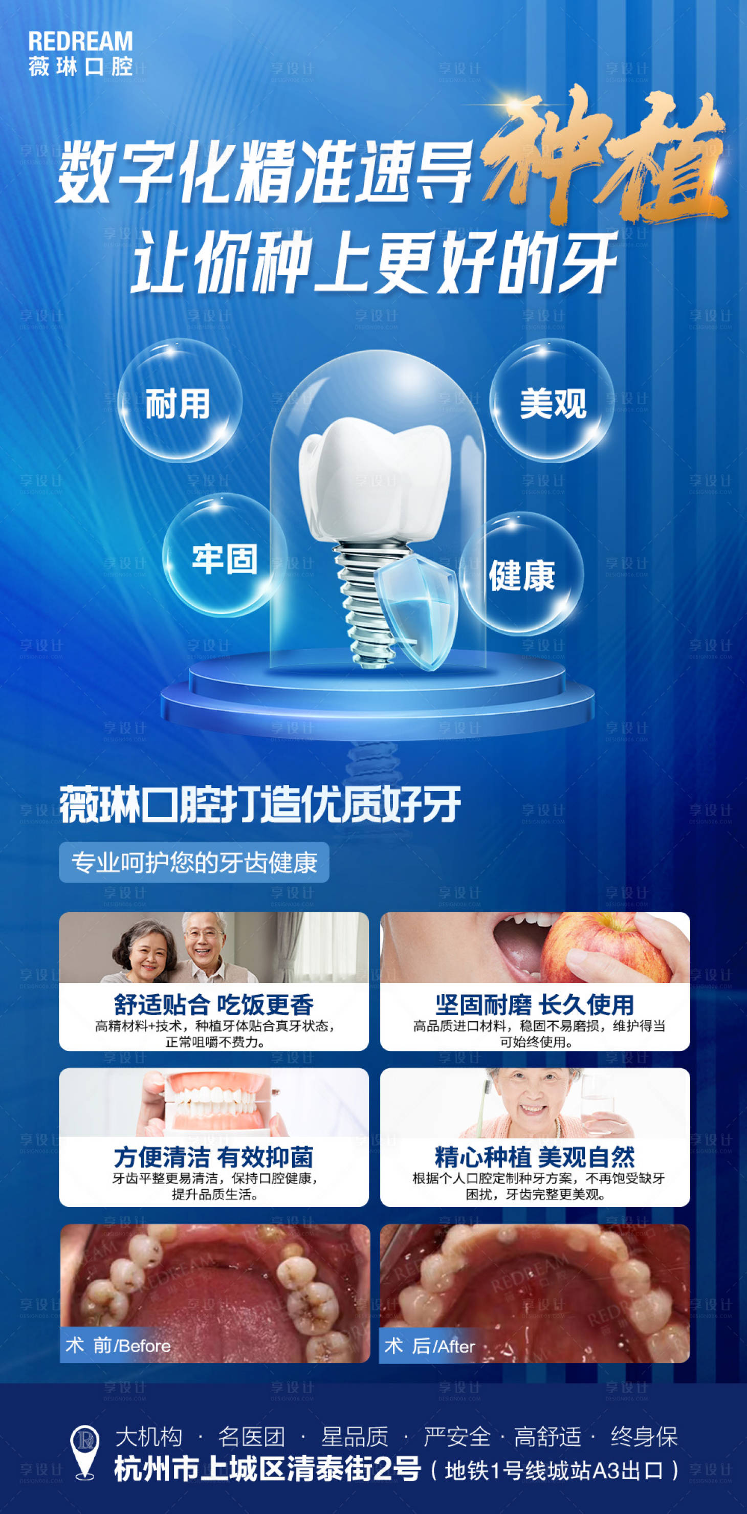 源文件下载【享设计】搜索编号：24540022682357693【口腔种植牙活动海报】