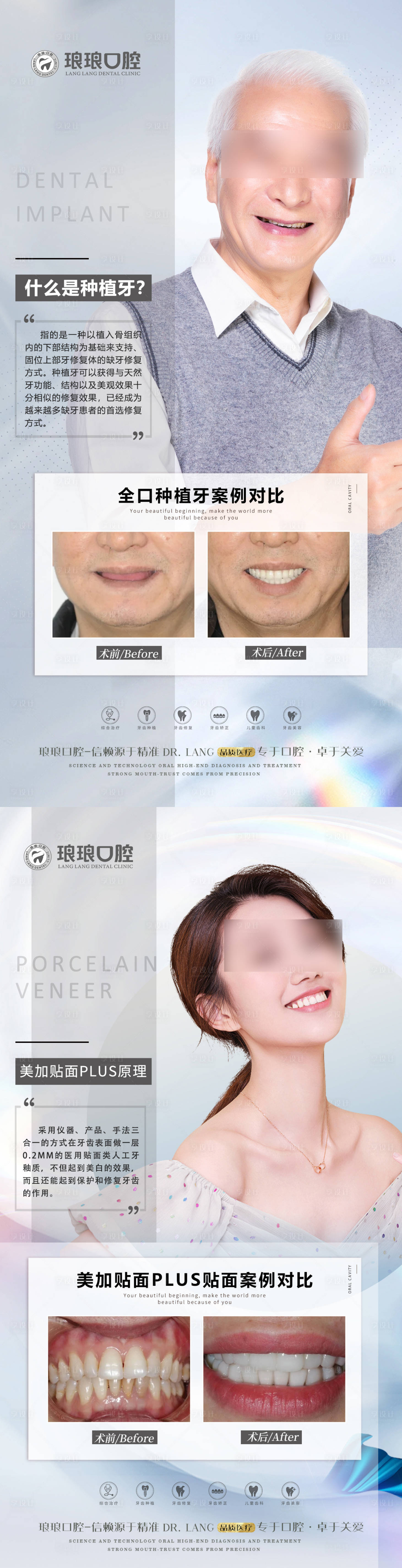 源文件下載【口腔種植牙貼面案例海報】編號：24570023104141545