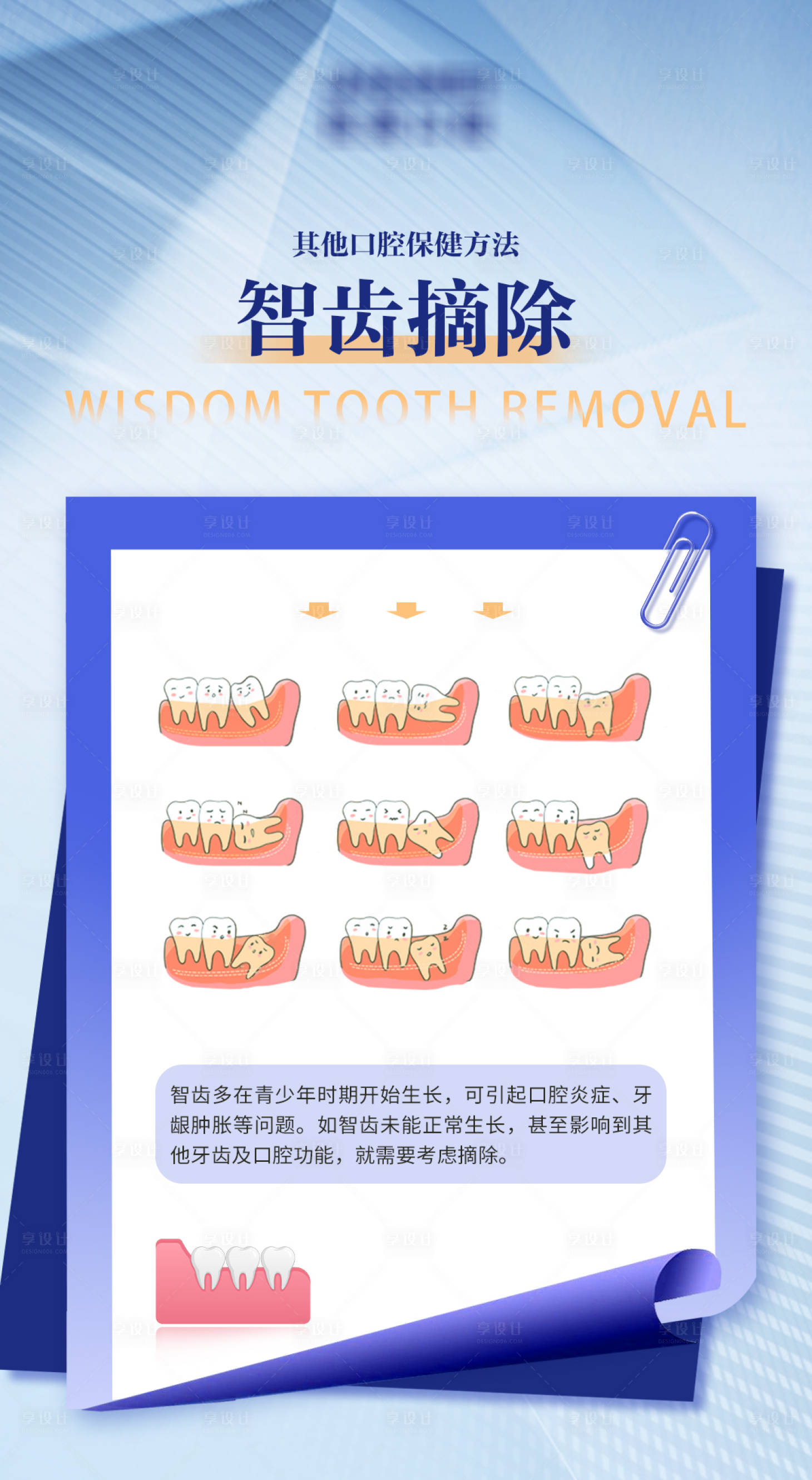 源文件下载【享设计】搜索编号：75860023403213471【口腔科普 】