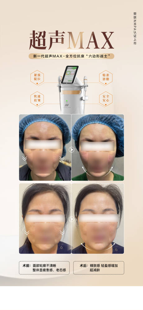 源文件下载【医美仪器抗衰案例海报】编号：90890023512945171