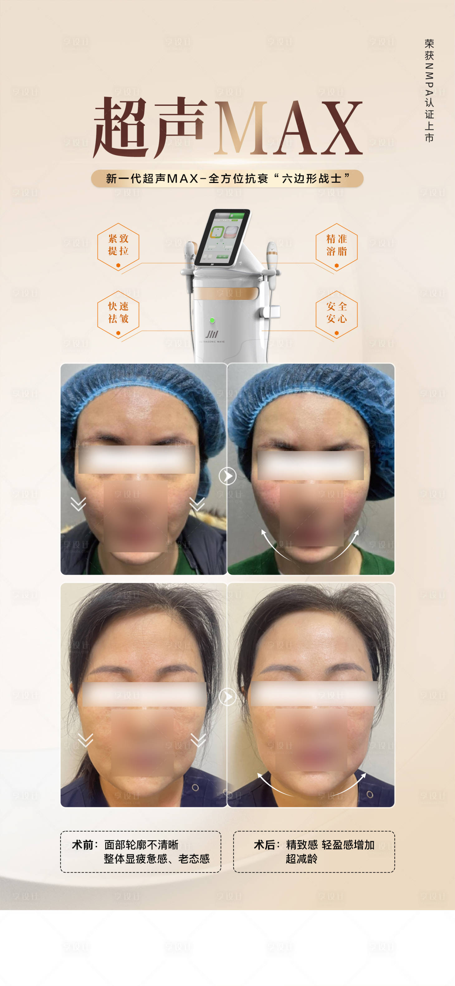 源文件下載【享設計】搜索編號：90890023512945171【醫美儀器抗衰案例海報】