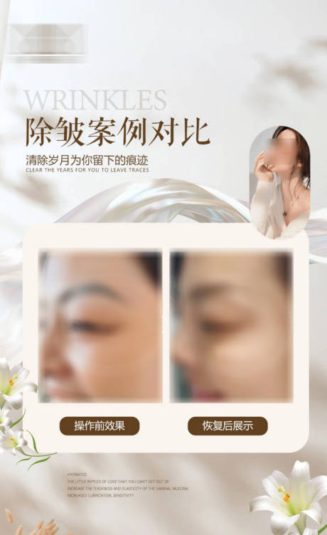 源文件下载【医美案例美业案例对比海报】编号：77330023112311106