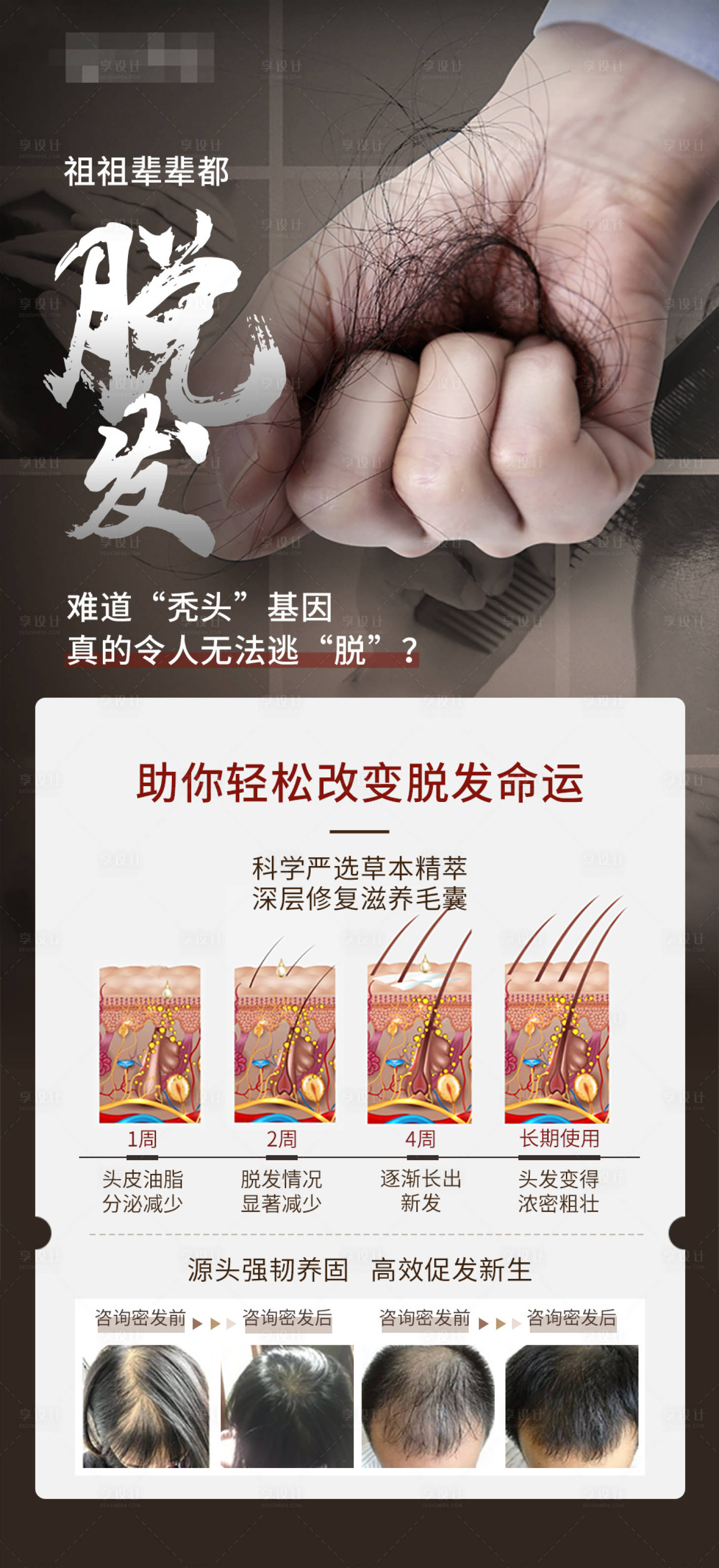 源文件下载【享设计】搜索编号：25140023637388414【脱发痛点海报】