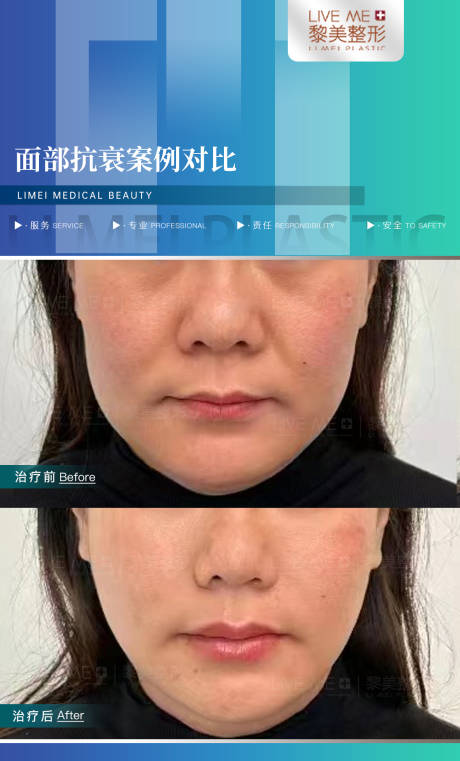 源文件下載【享設計】搜索編號：40240023303942642【醫美案例對比模板海報】