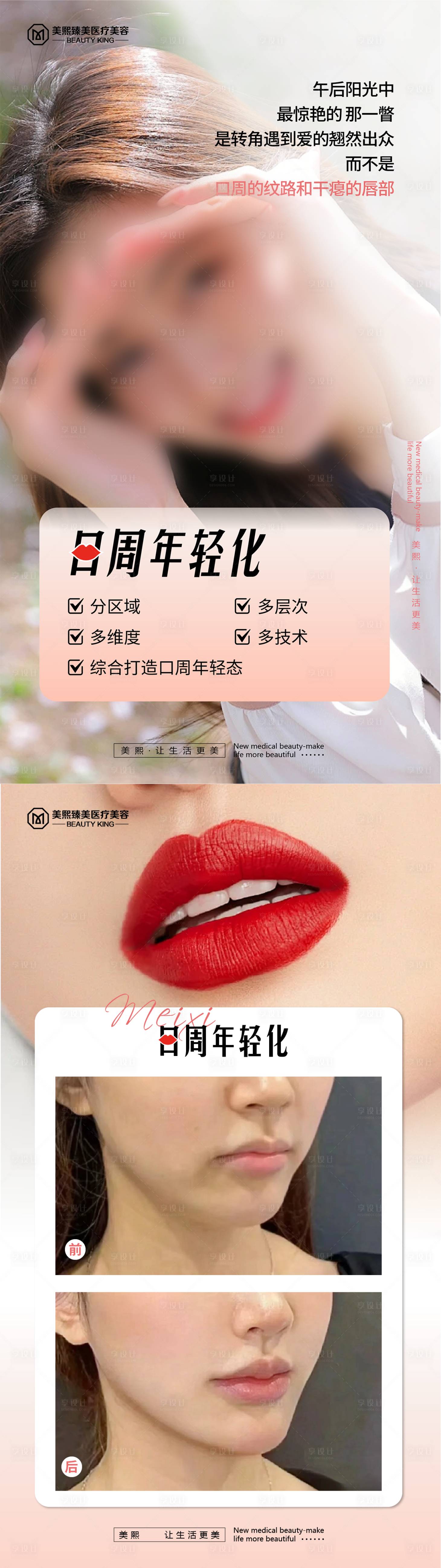 源文件下載【享設(shè)計(jì)】搜索編號：39080023150252852【口周年輕化醫(yī)美系列海報(bào)】