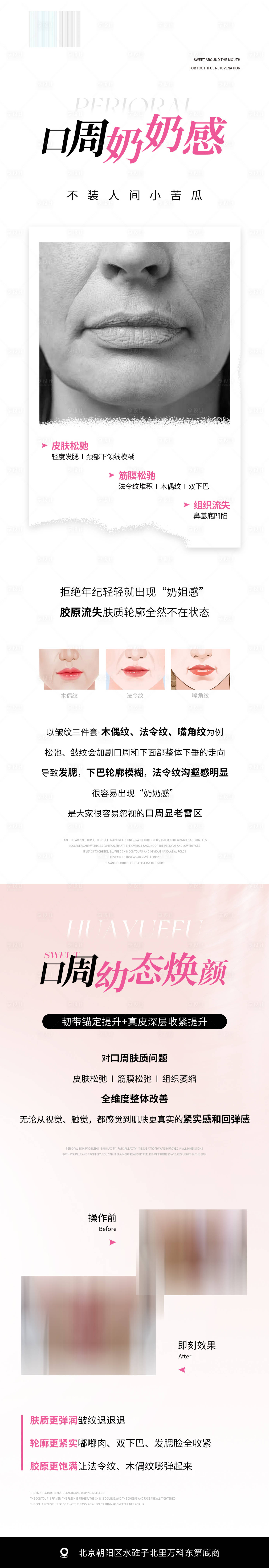 源文件下載【享設(shè)計(jì)】搜索編號(hào)：97770023325795960【口周抗衰醫(yī)美項(xiàng)目海報(bào)】