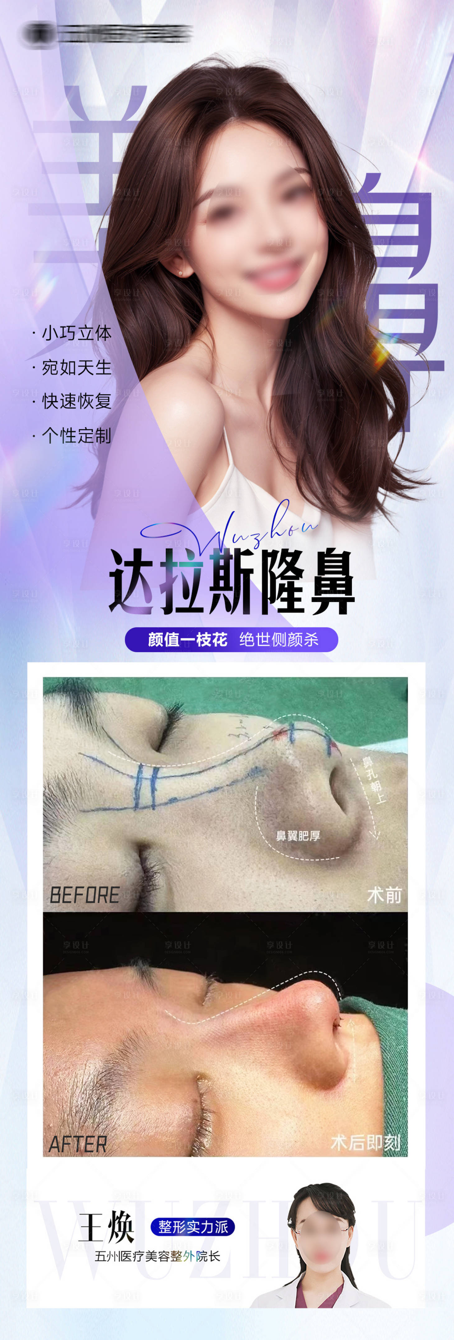 源文件下載【享設計】搜索編號：39420023183676105【醫美隆鼻案例長圖】