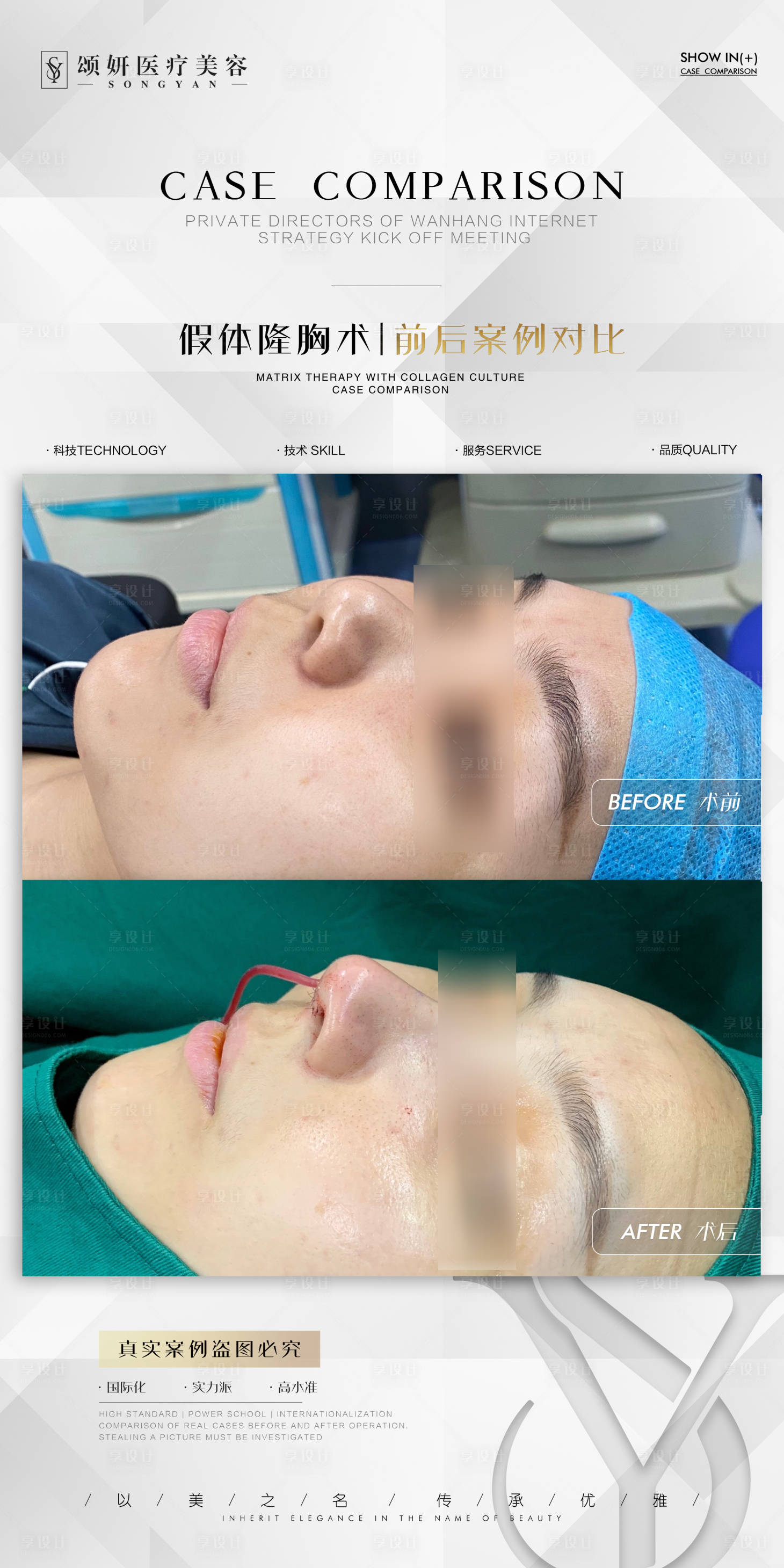 源文件下载【享设计】搜索编号：85020023294978157【医美案例对比海报】
