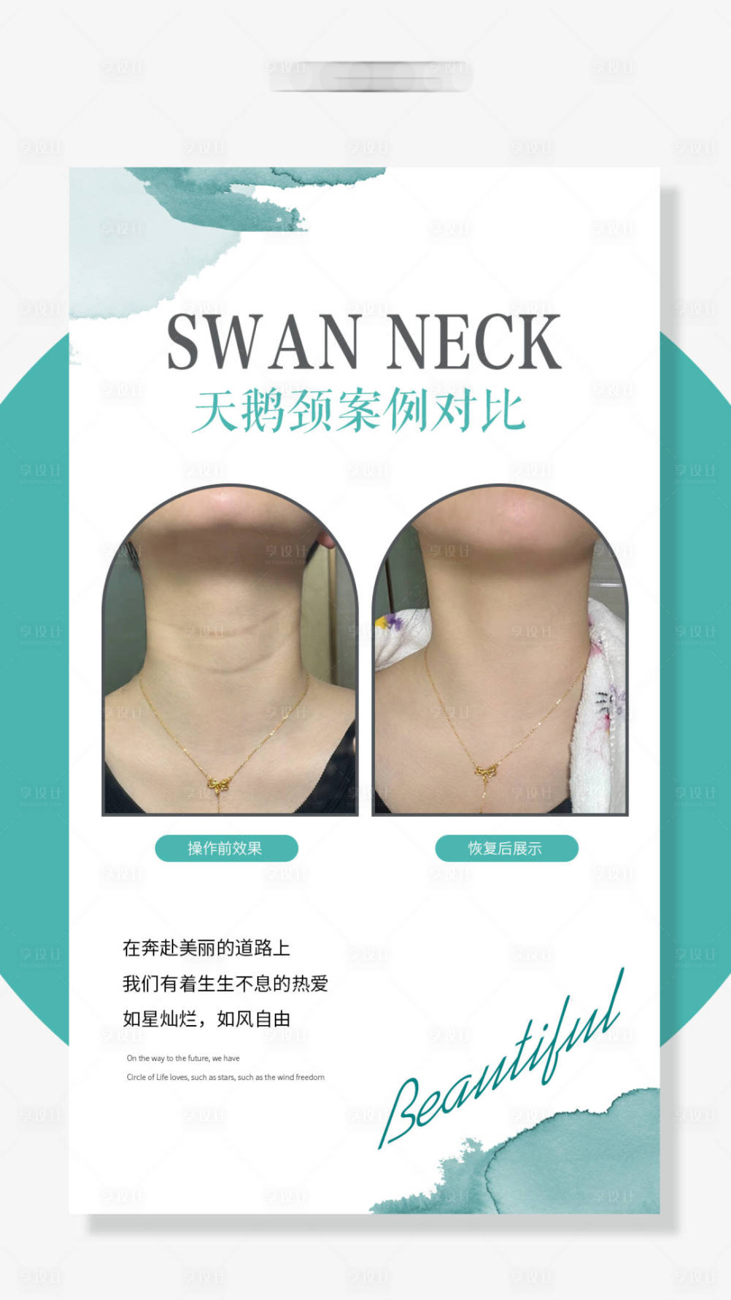 源文件下載【享設(shè)計(jì)】搜索編號(hào)：97220022952005140【醫(yī)美海報(bào)】