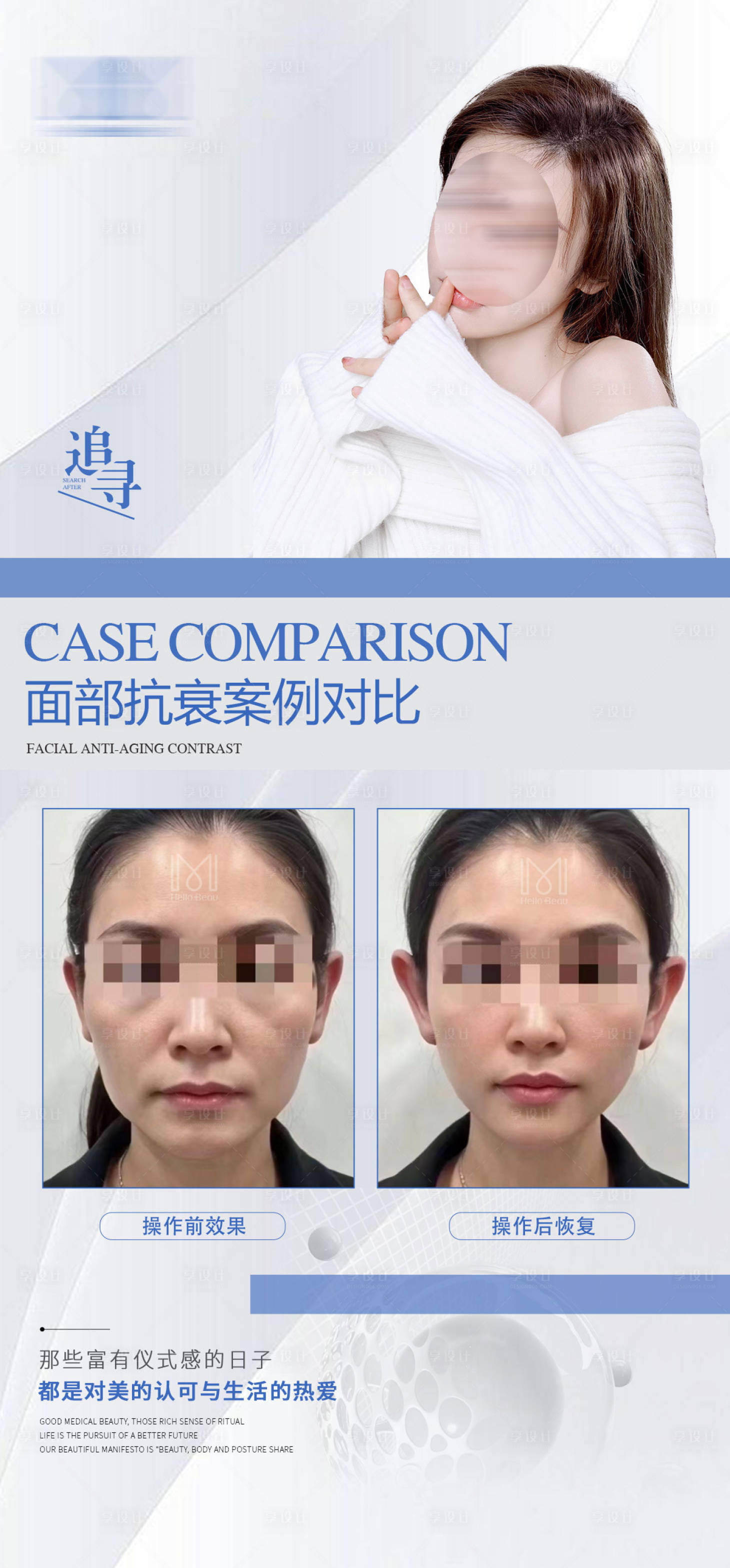 源文件下載【醫美案例美業案例對比海報】編號：58240023049387005