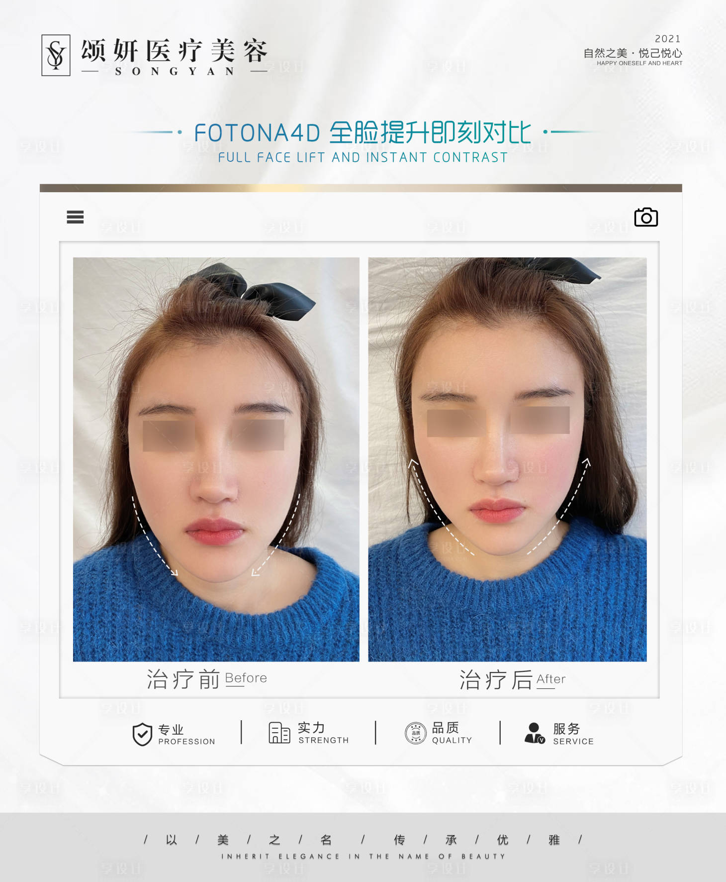 源文件下载【享设计】搜索编号：82470023295155531【医美案例对比海报】