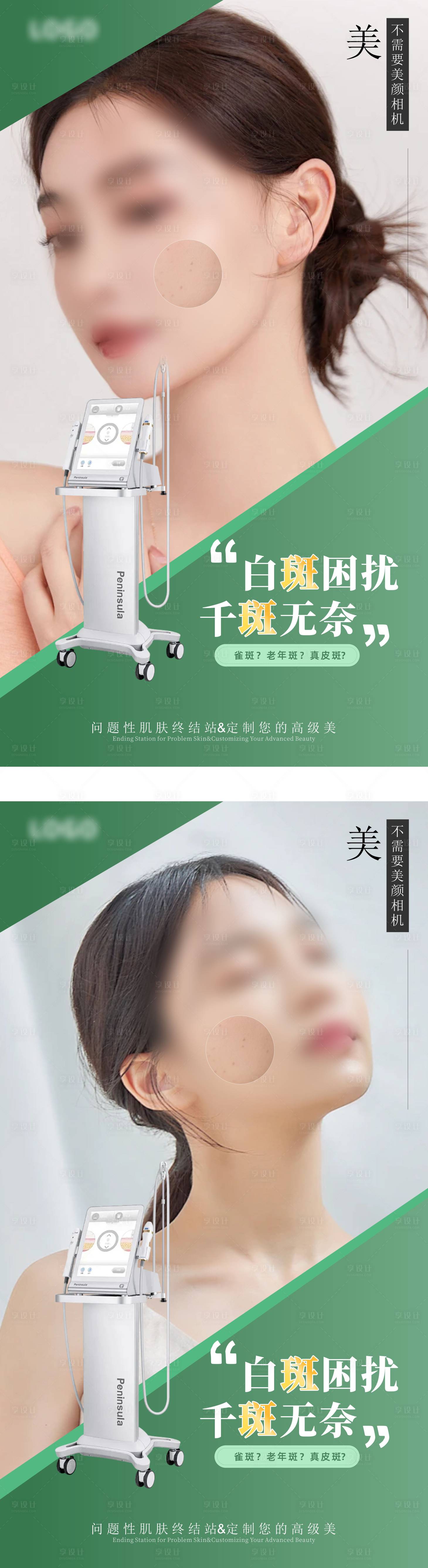 源文件下载【享设计】搜索编号：71200023240853665【医美祛斑朋友圈海报】