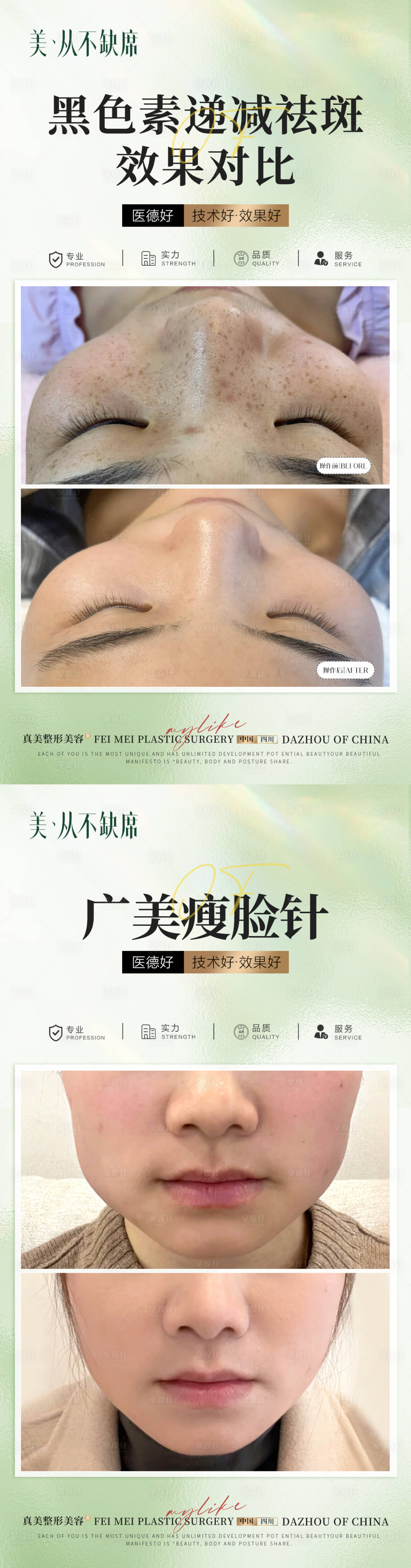 源文件下载【医美绿色简约案例】编号：22250023103706939