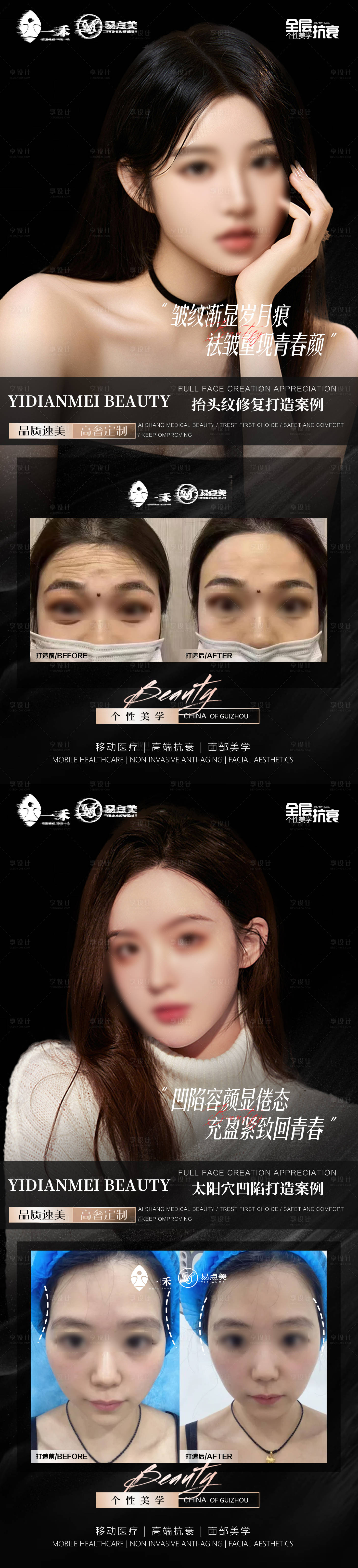 源文件下载【享设计】搜索编号：27960023050275494【黑金轻医美案例对比图海报】