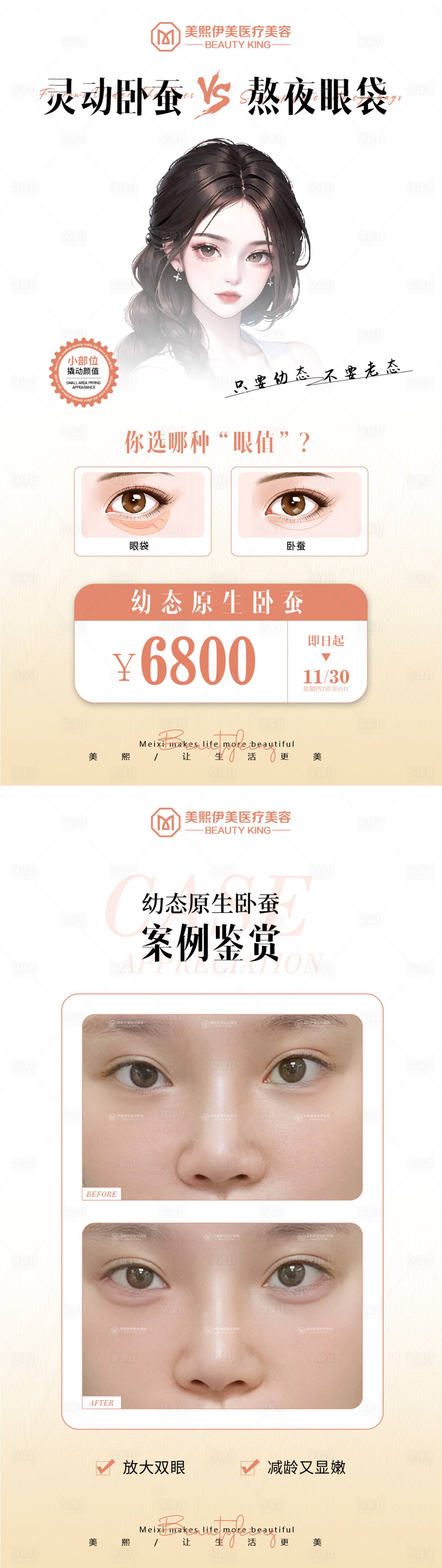 源文件下载【享设计】搜索编号：98180023150536931【灵动卧蚕医美系列海报】