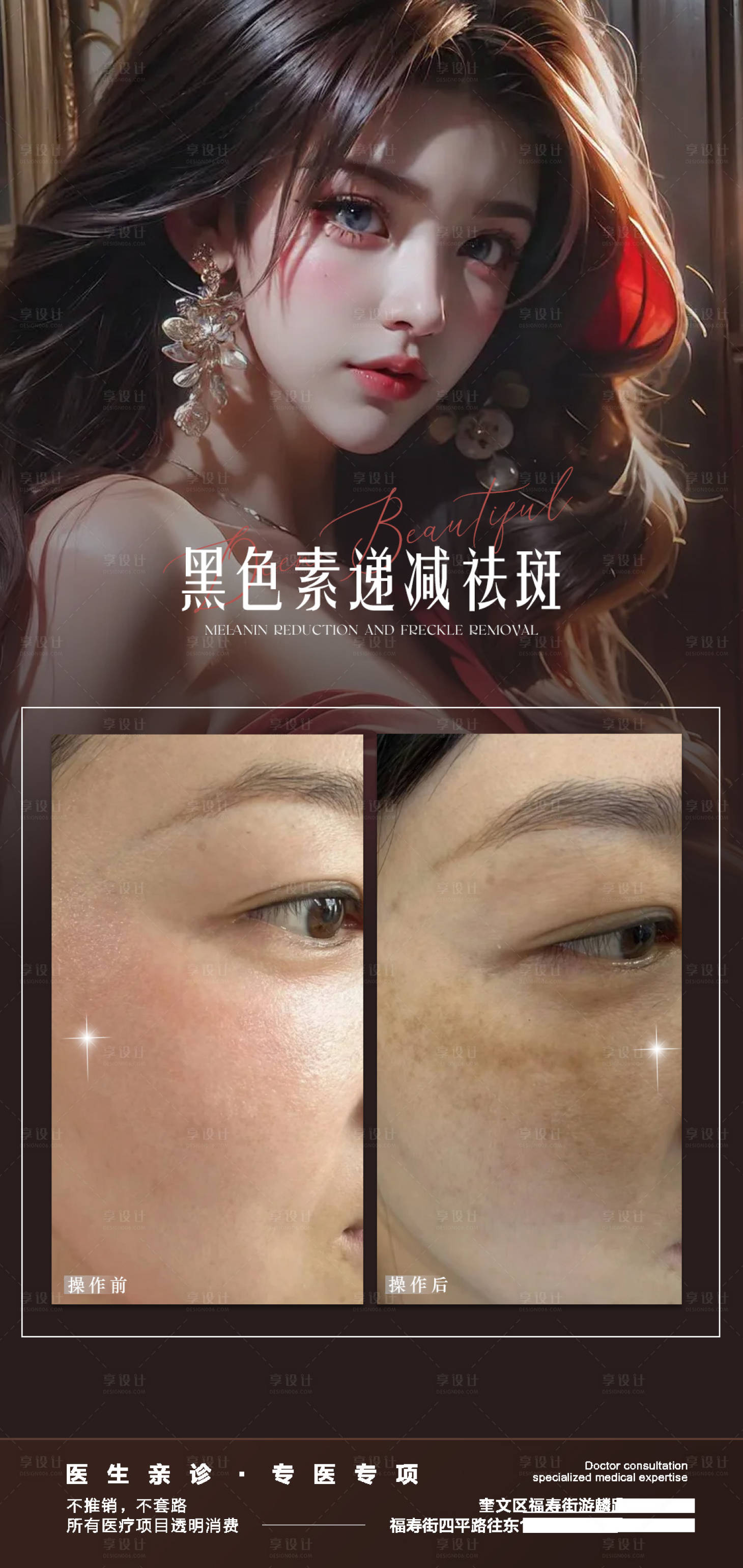 源文件下载【享设计】搜索编号：13590023207206623【祛斑案例海报】