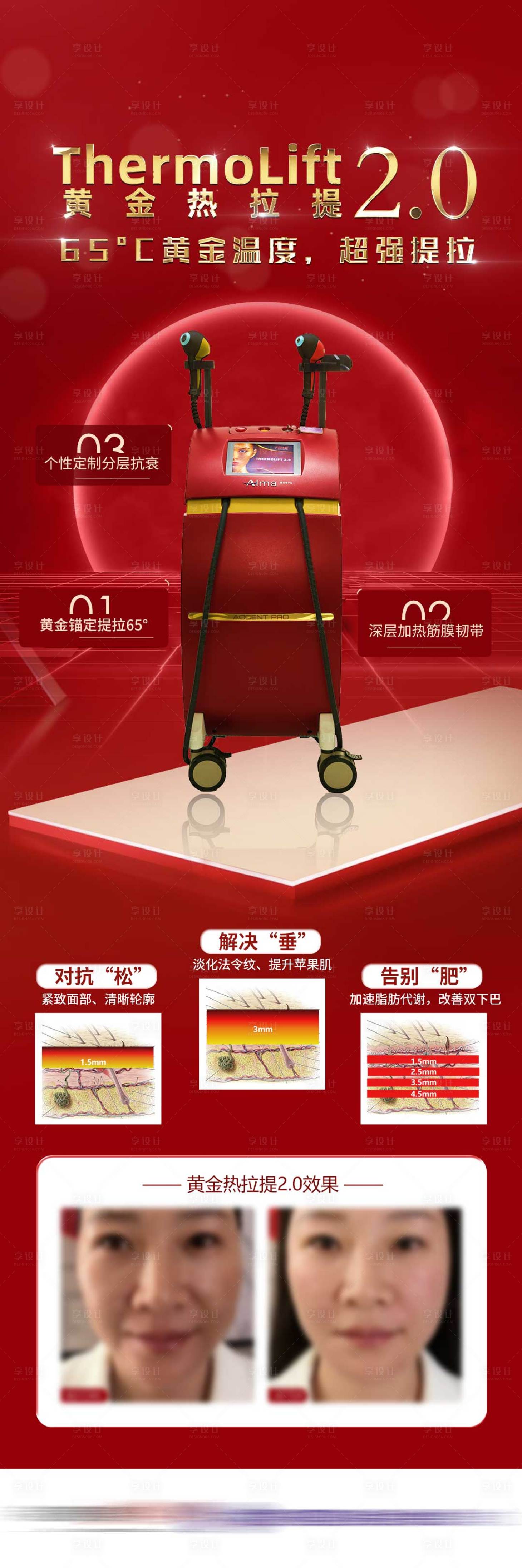 源文件下载【享设计】搜索编号：46240023592672539【黄金热拉提红金版本医美仪器海报】