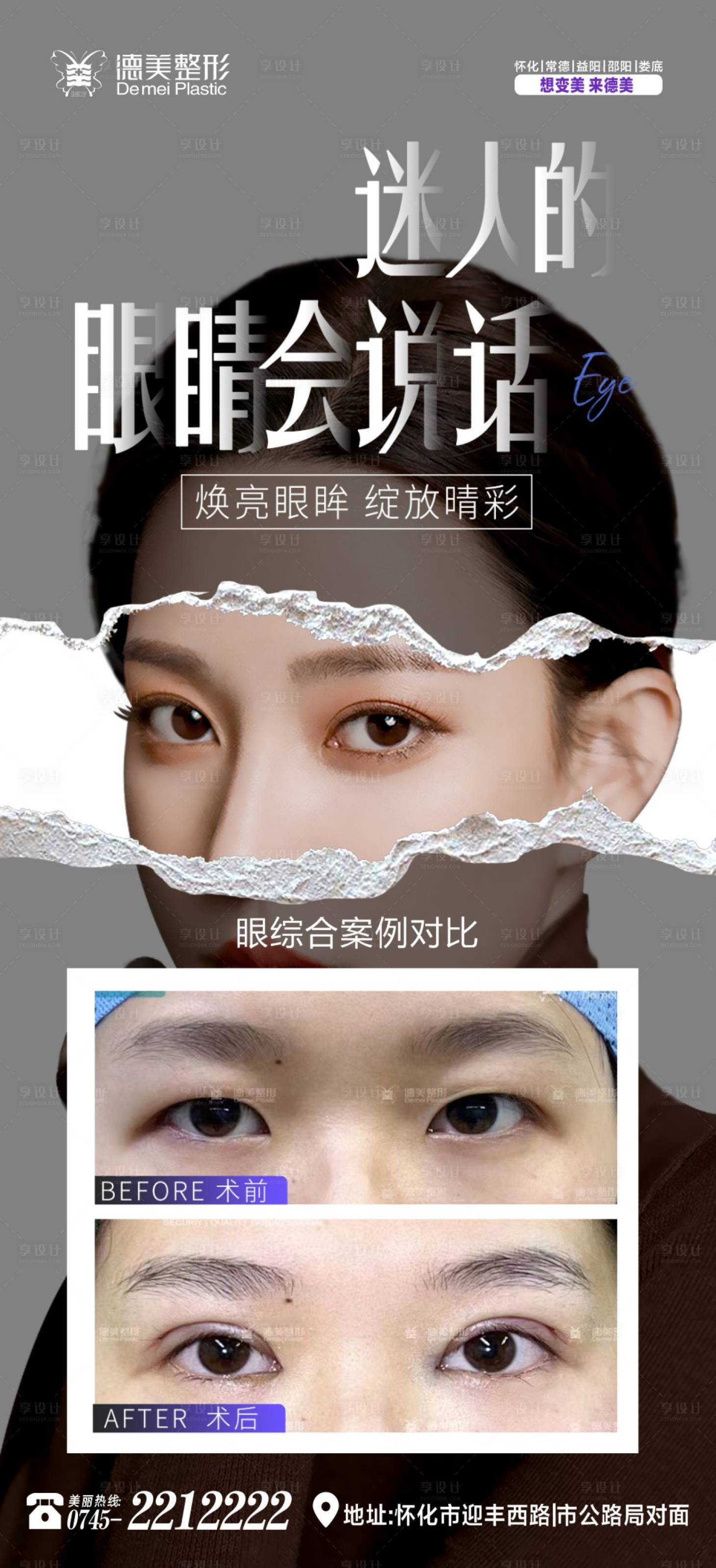 源文件下載【享設計】搜索編號：15050023011839308【眼綜合案例對比海報】