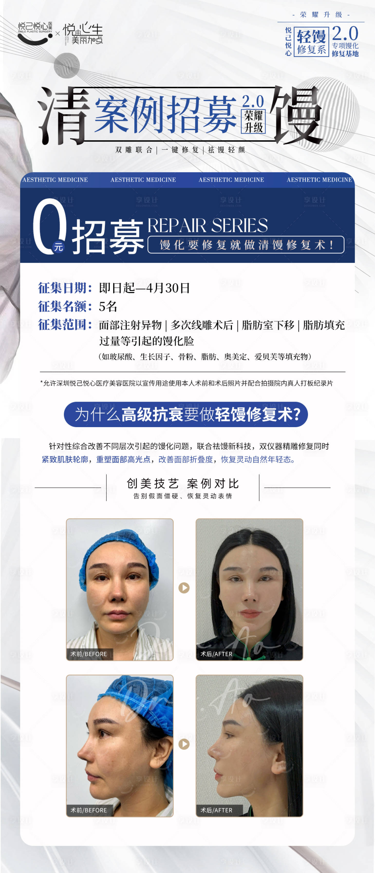 源文件下载【享设计】搜索编号：67220023369365794【清馒术案例招募作品】