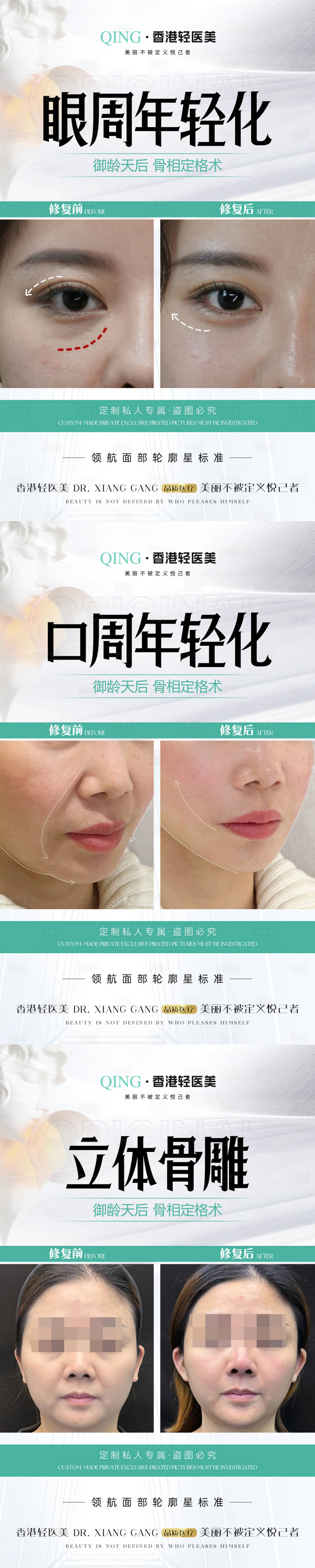 源文件下载【医美立体骨雕眼周口周案例海报】编号：56030023252233508