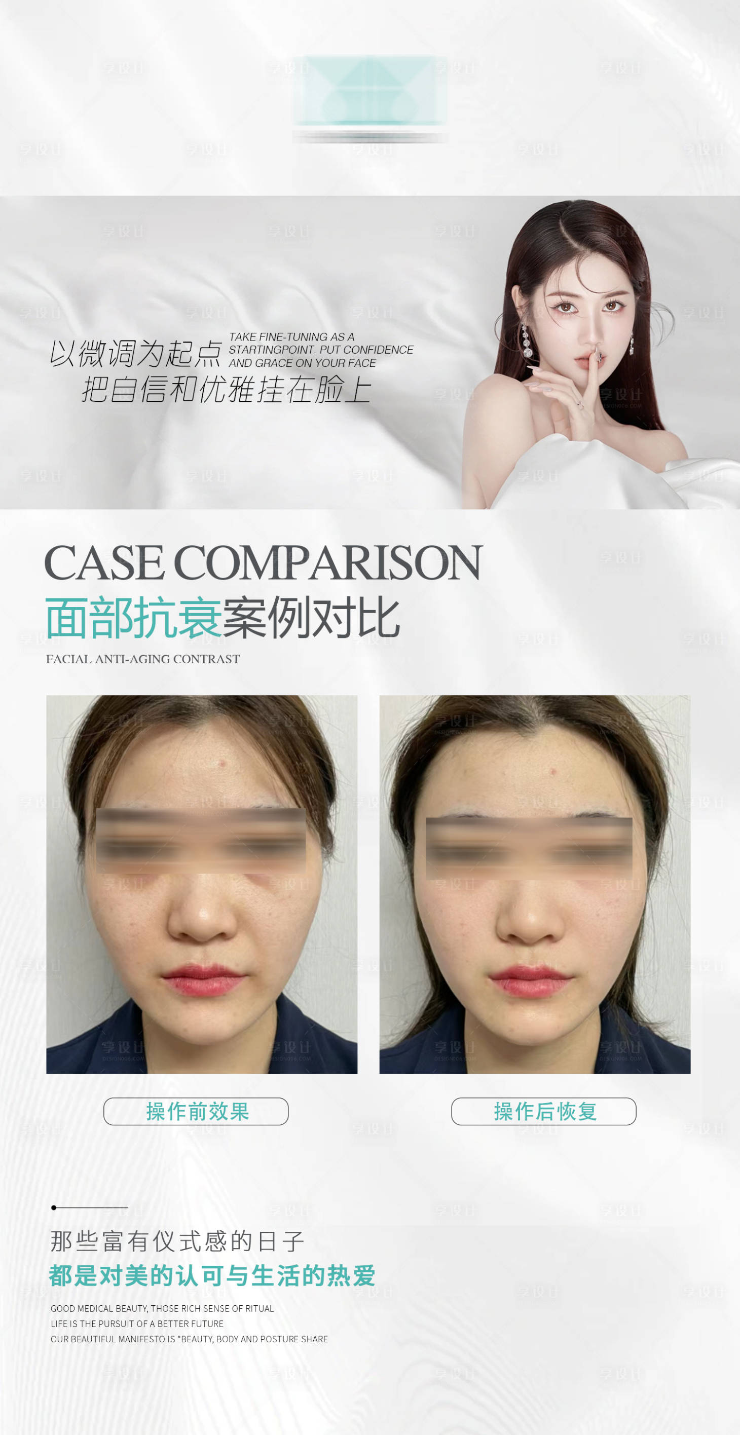 源文件下載【享設計】搜索編號：98360023045225126【醫美案例對比海報】
