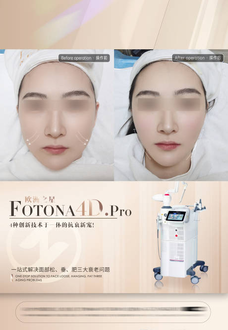源文件下載【享設(shè)計(jì)】搜索編號(hào)：49200023047702899【醫(yī)美案例對(duì)比圖設(shè)計(jì)海報(bào)】