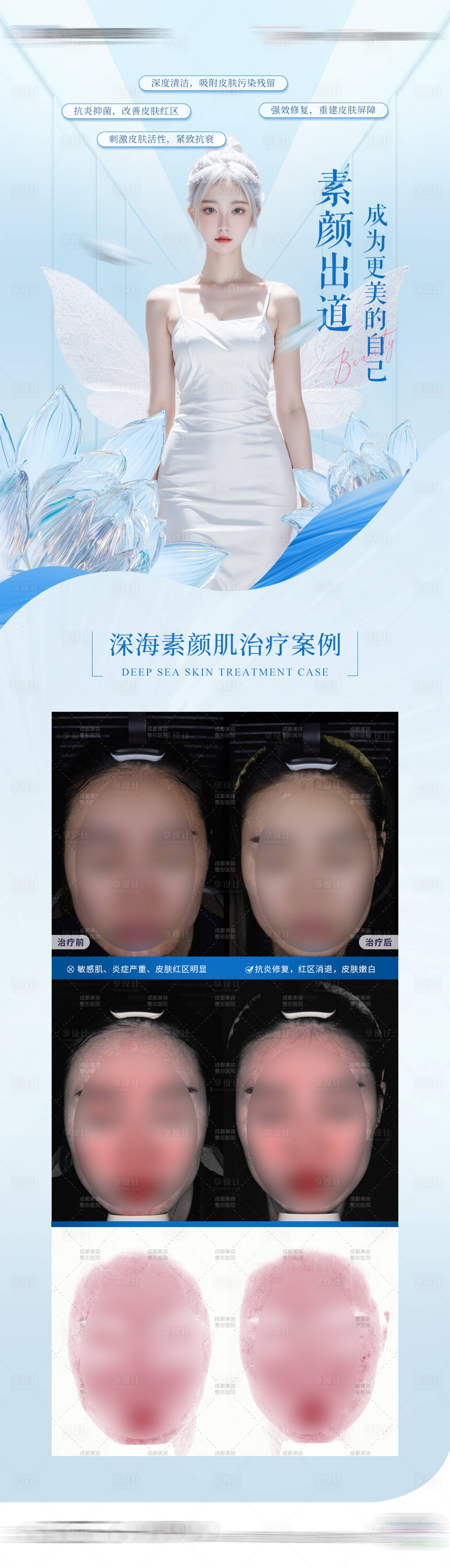 源文件下载【享设计】搜索编号：26890023381635652【医美皮肤案例长图海报】