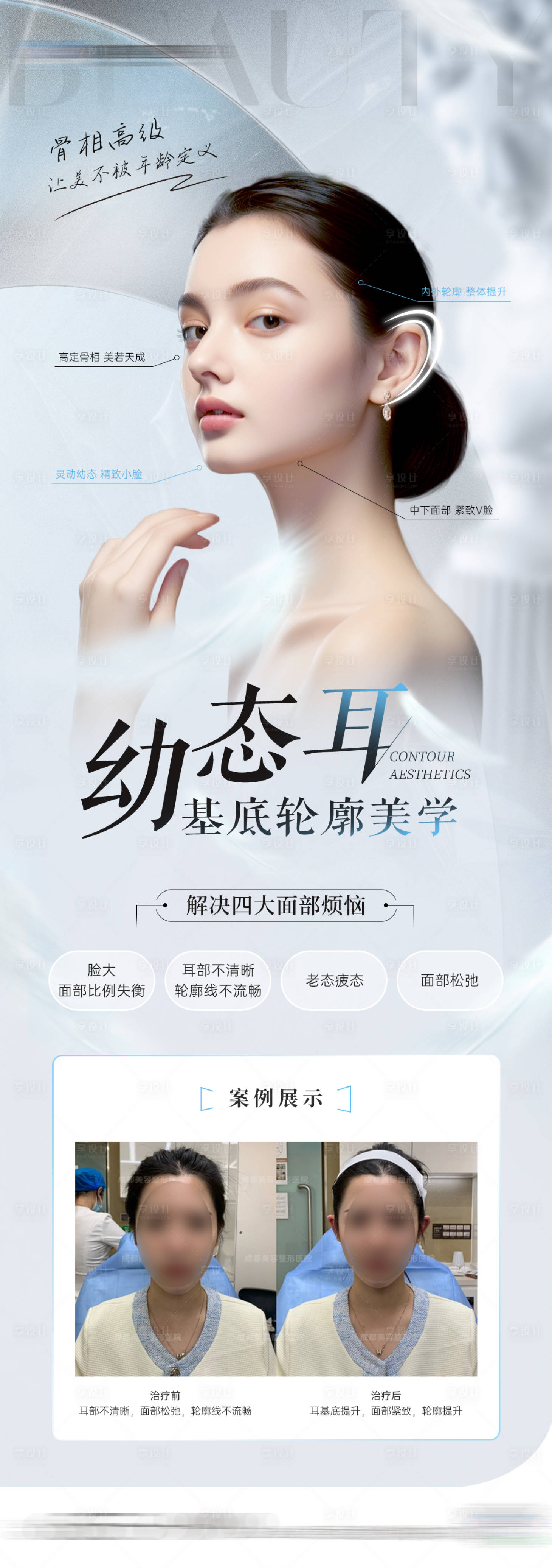源文件下载【享设计】搜索编号：24830023296002605【医美幼态耳轮廓美学长图海报】