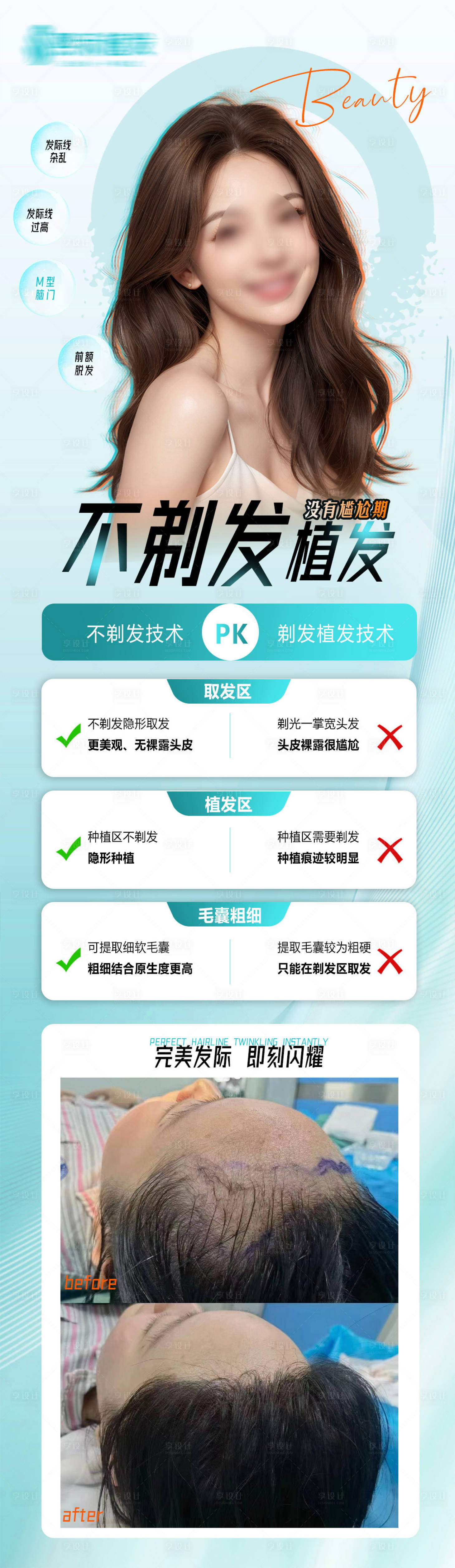 源文件下载【不剃发植发海报】编号：56510023265926167