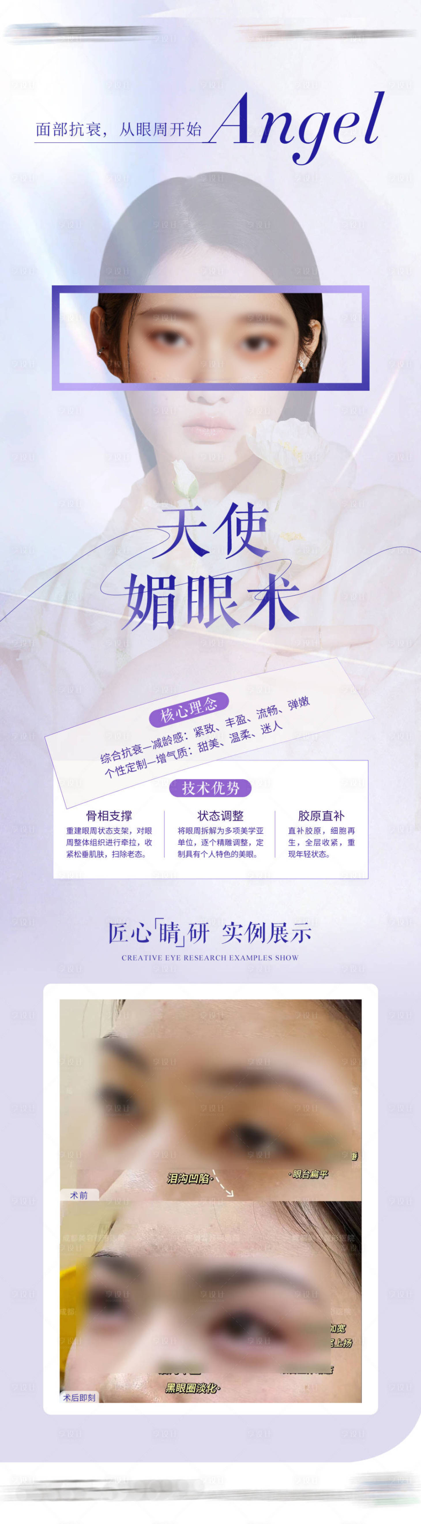 源文件下载【医美媚眼术海报】编号：80660023550358007