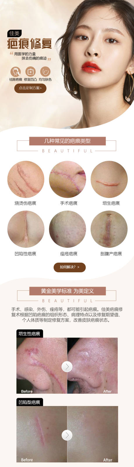 源文件下載【享設計】搜索編號：98670022984955335【疤痕修復詳情頁】