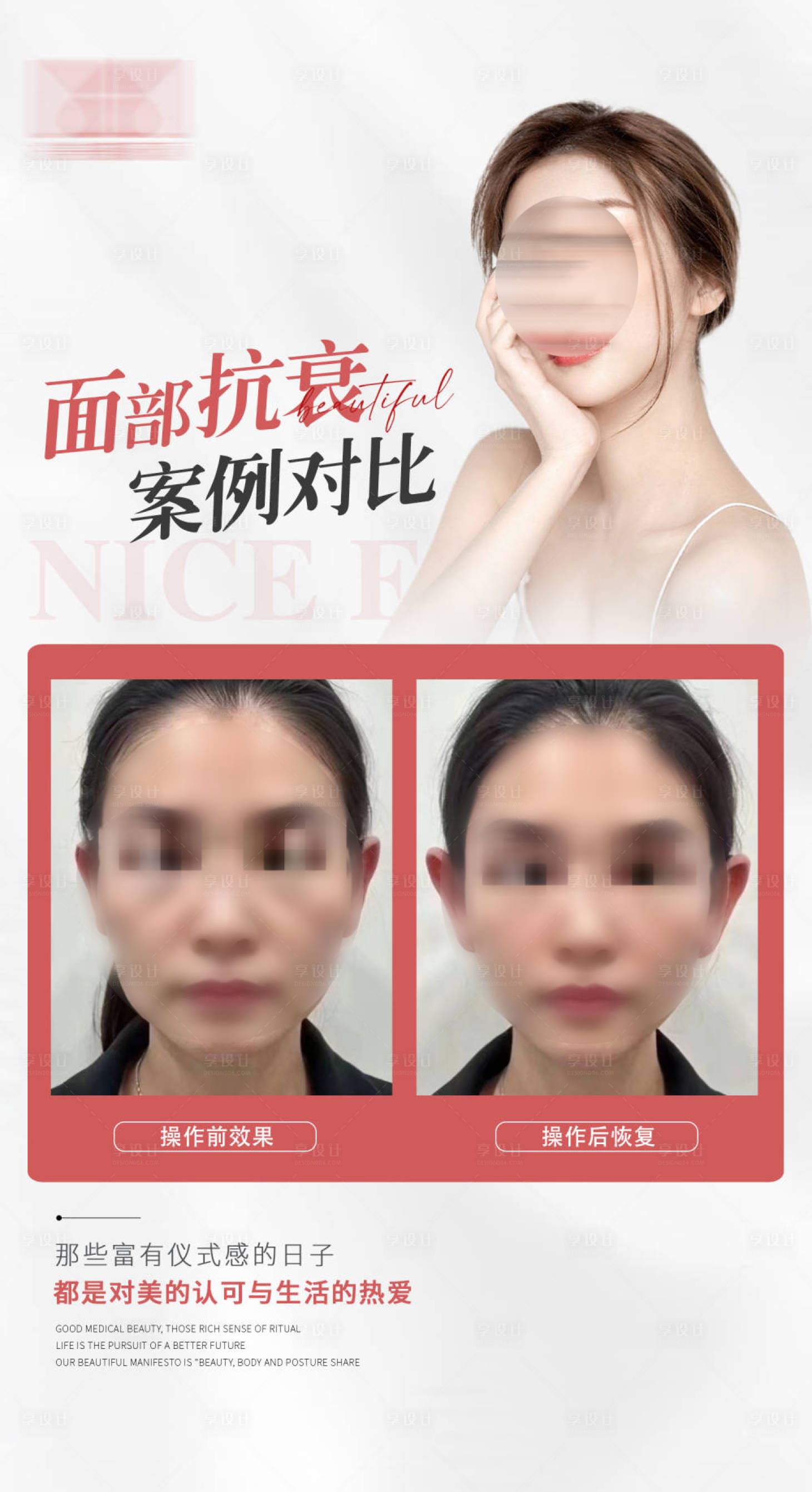 源文件下载【享设计】搜索编号：80100023057124678【医美案例海报】