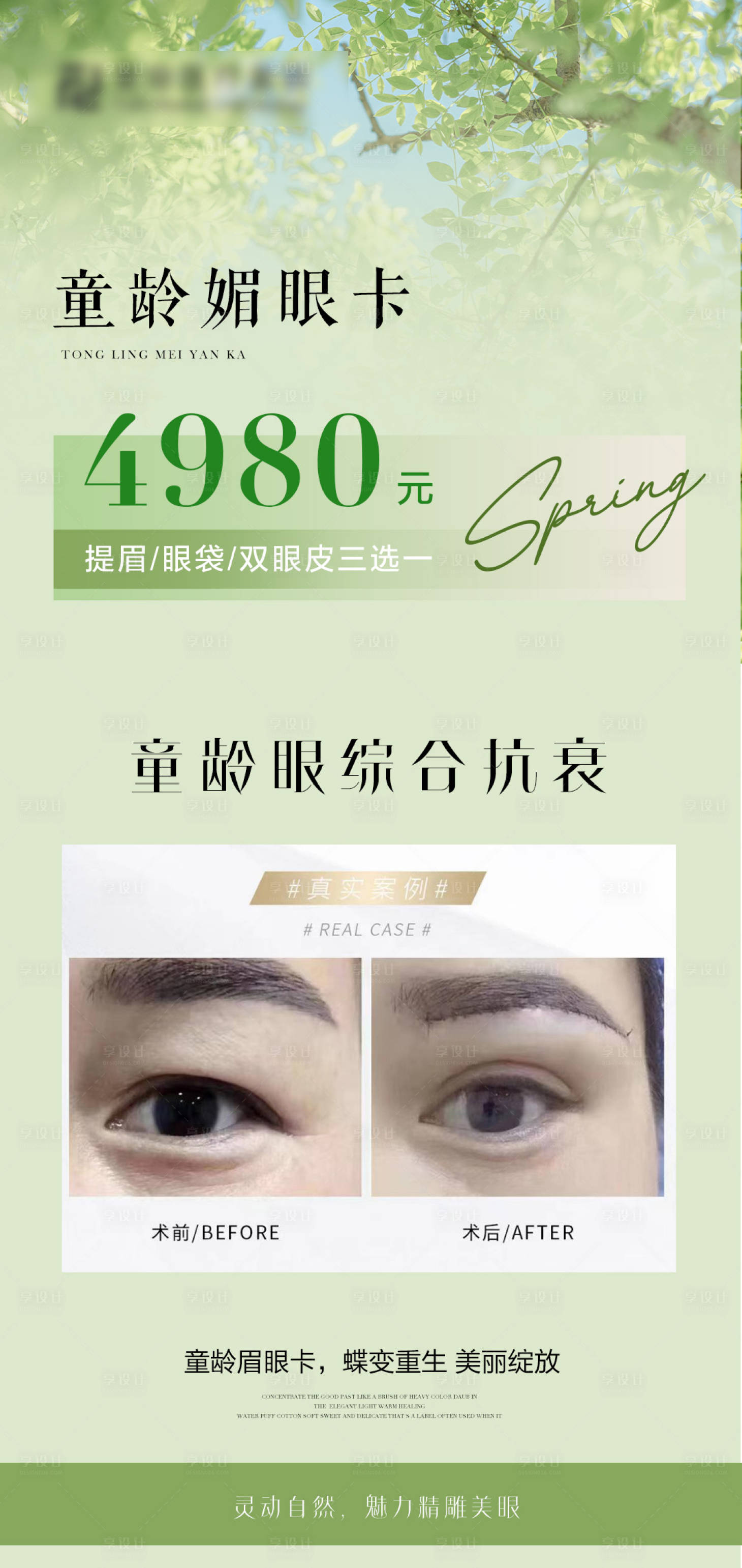 源文件下载【享设计】搜索编号：55560023273777899【双眼皮医美海报】