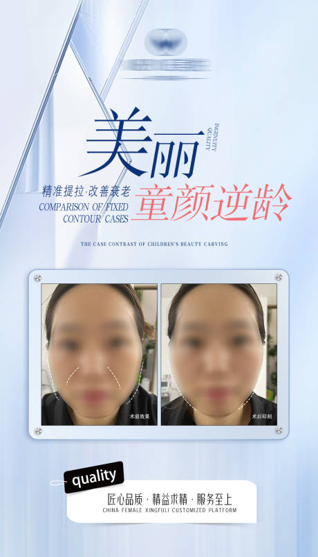 源文件下載【享設(shè)計(jì)】搜索編號(hào)：75390022954037782【醫(yī)美案例美業(yè)案例對(duì)比海報(bào)】